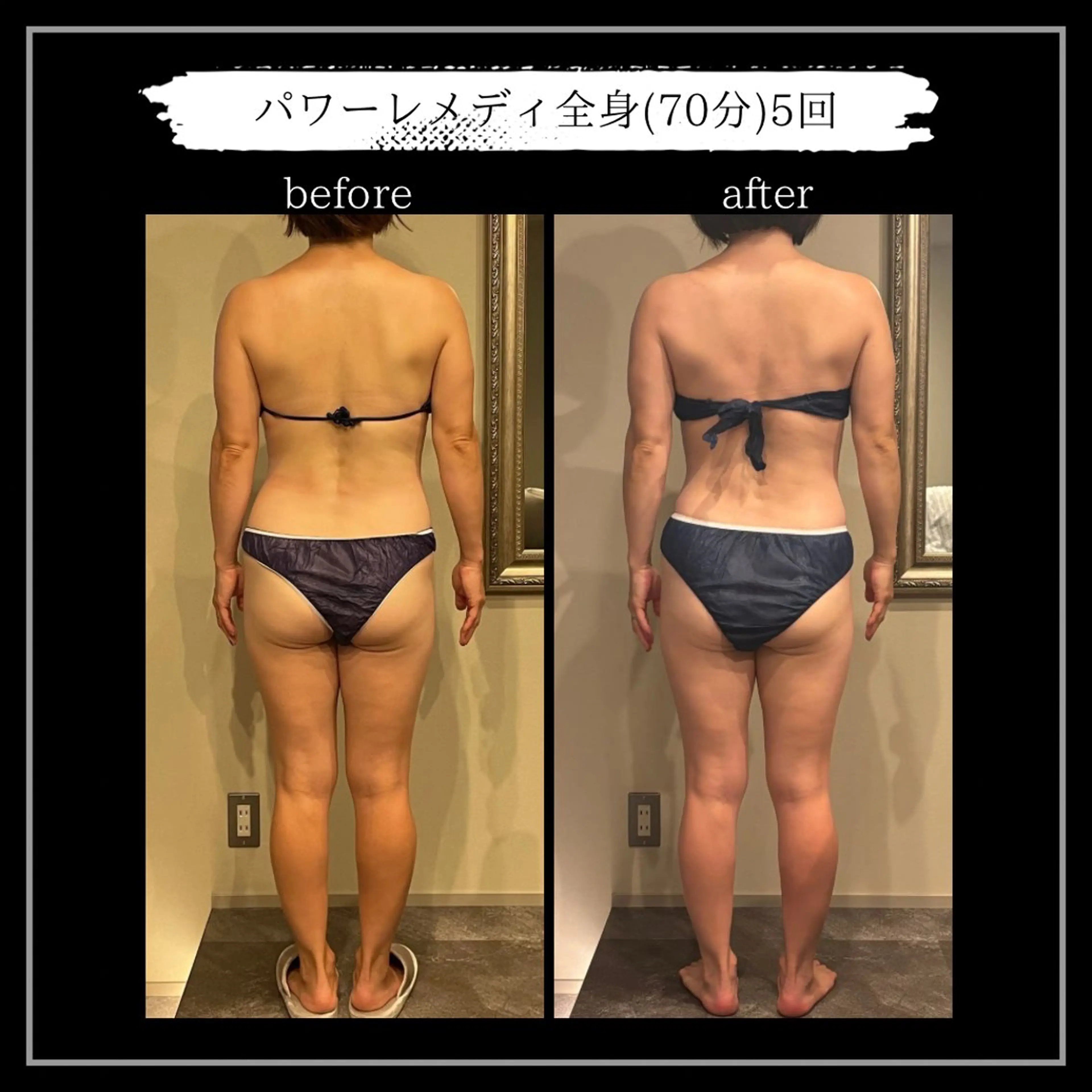 オフ:オン所属・オフ:オン 全身筋膜マッサージのエステ・リラクイメージ