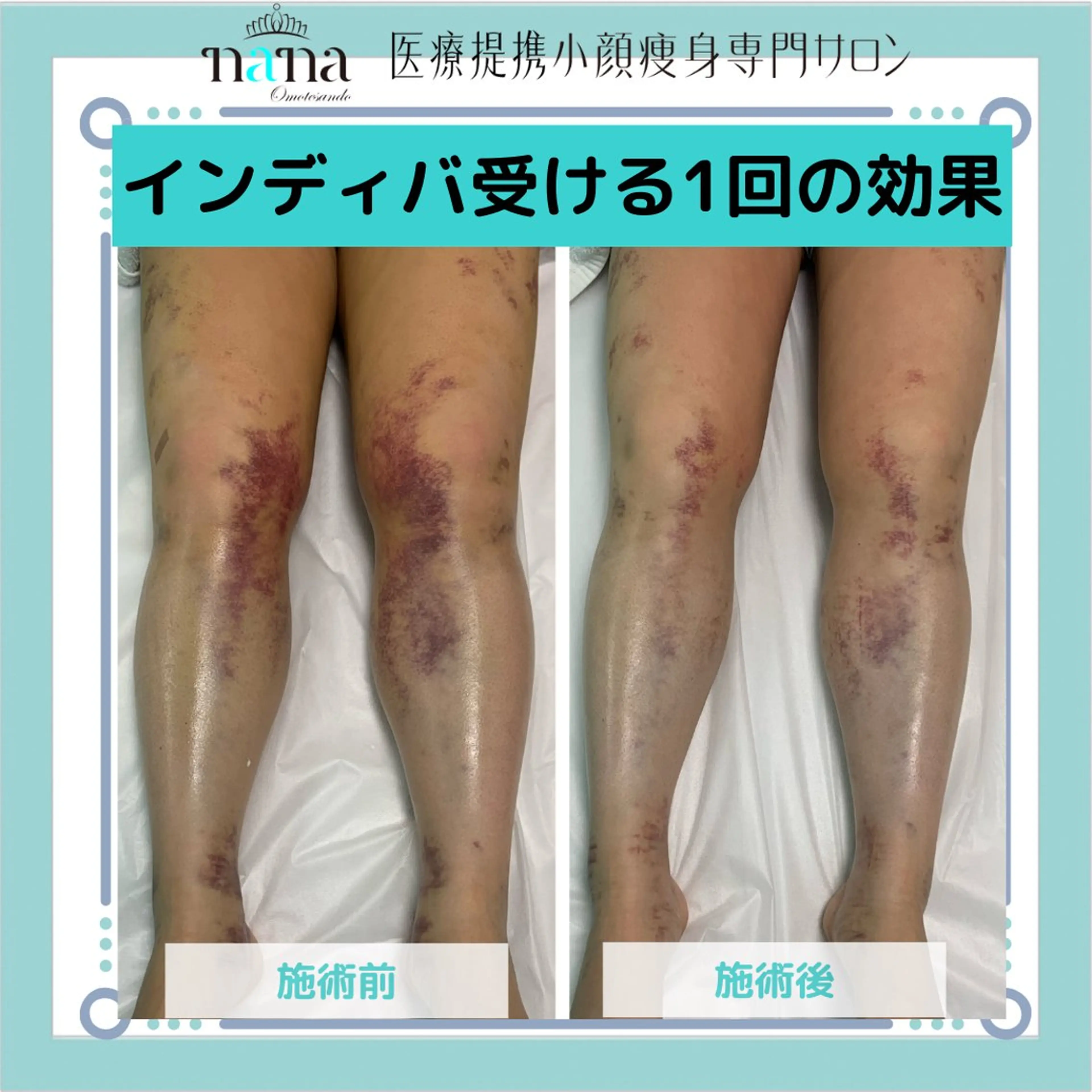 エステ リラク 小顔痩身インディバ Nana表参道のエステ・リラクイメージ