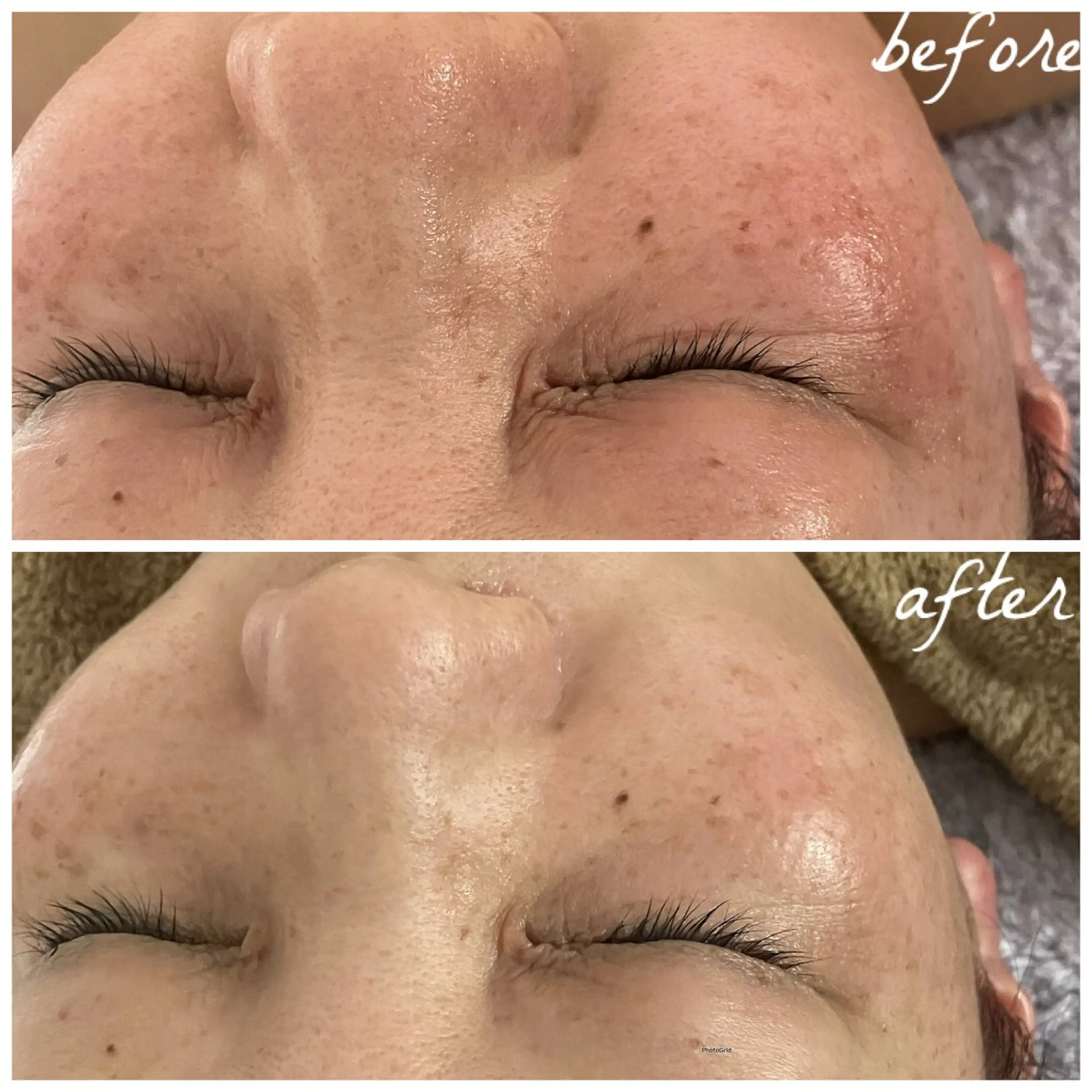 メンズ エステ メナード岐阜茜部 杉浦のエステ・リラクイメージ