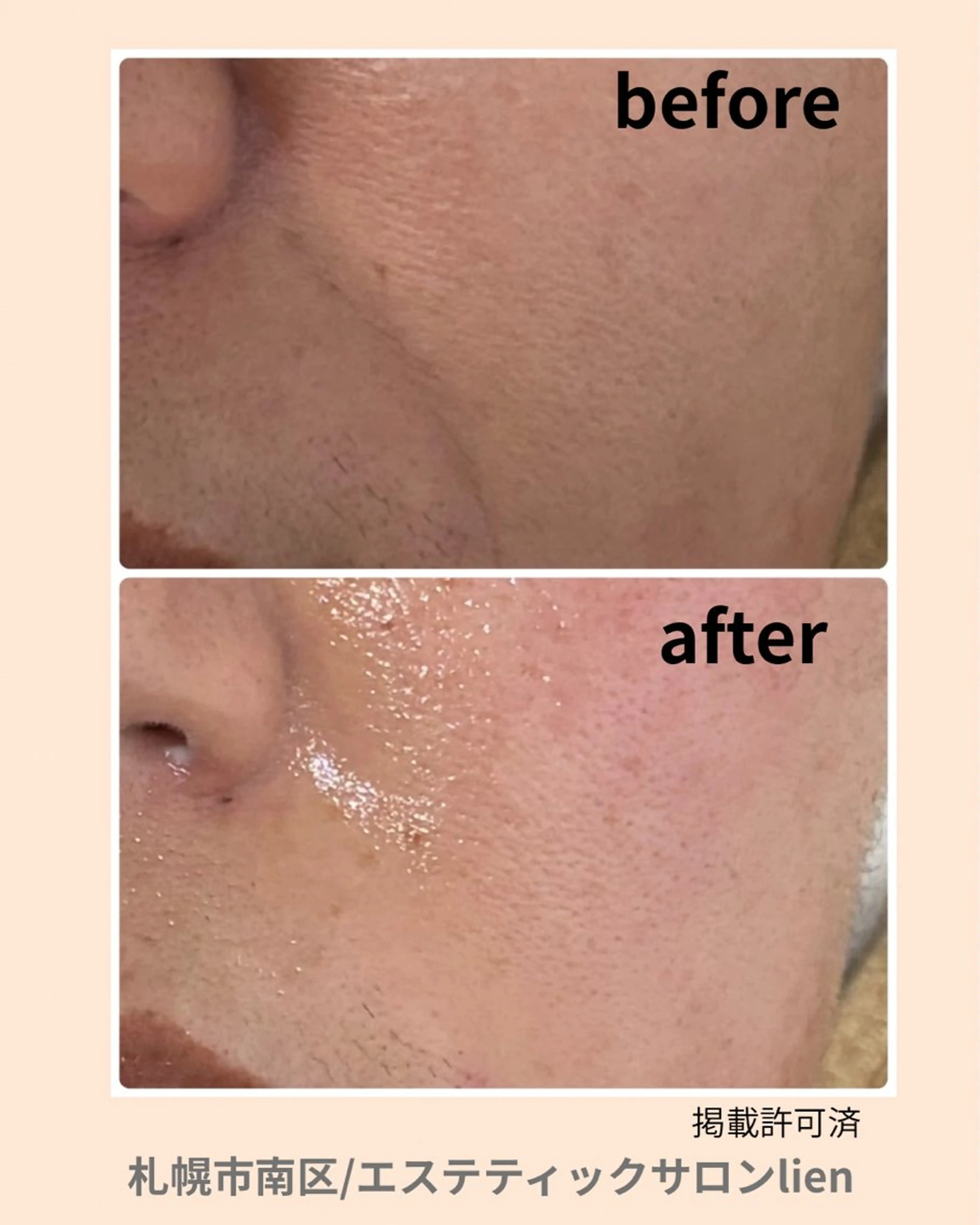 エステティックサロン　リアン所属・hiro_ narisのエステ・リラクイメージ