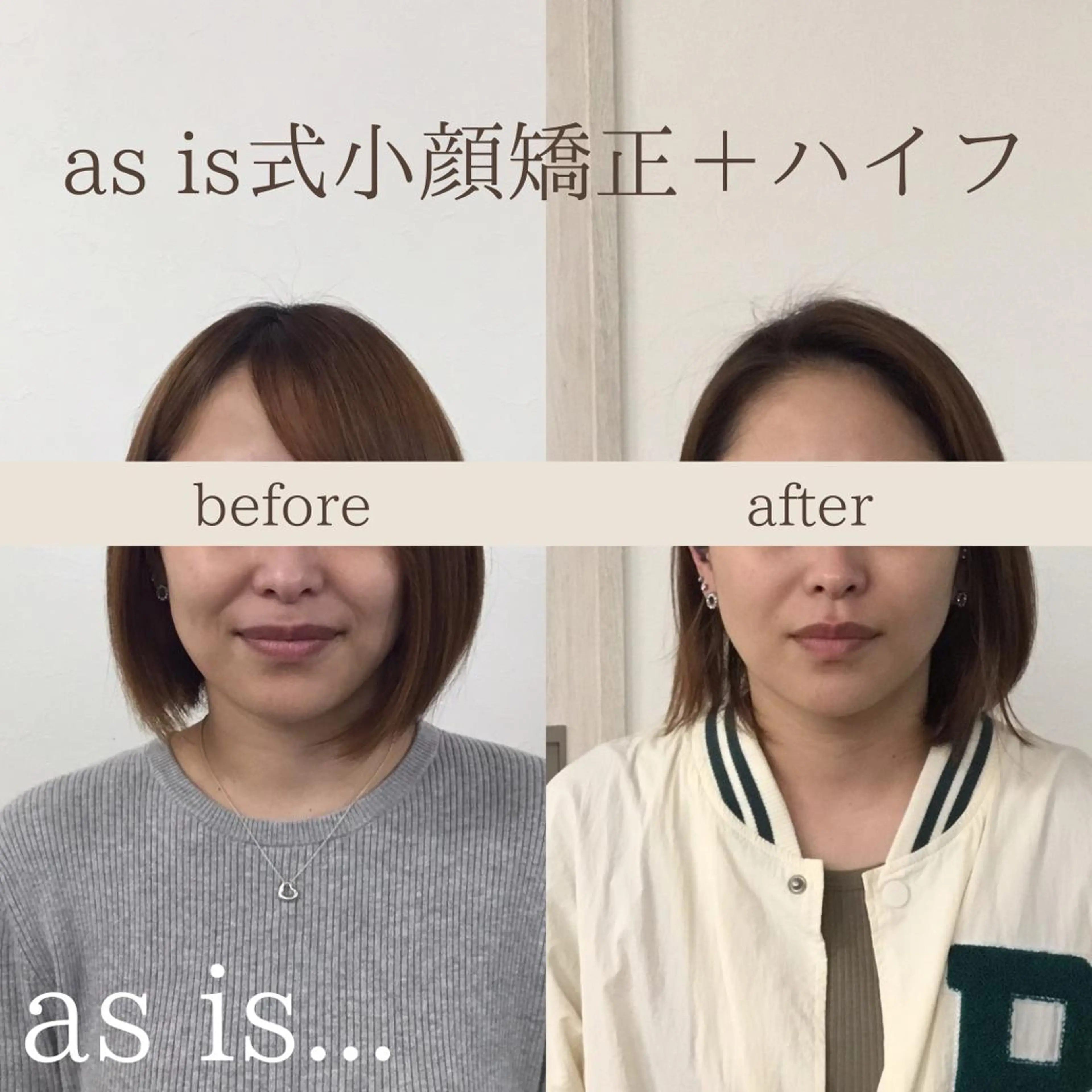 小顔専門アズイズ ビューティー　草津店のエステ・リラクイメージ