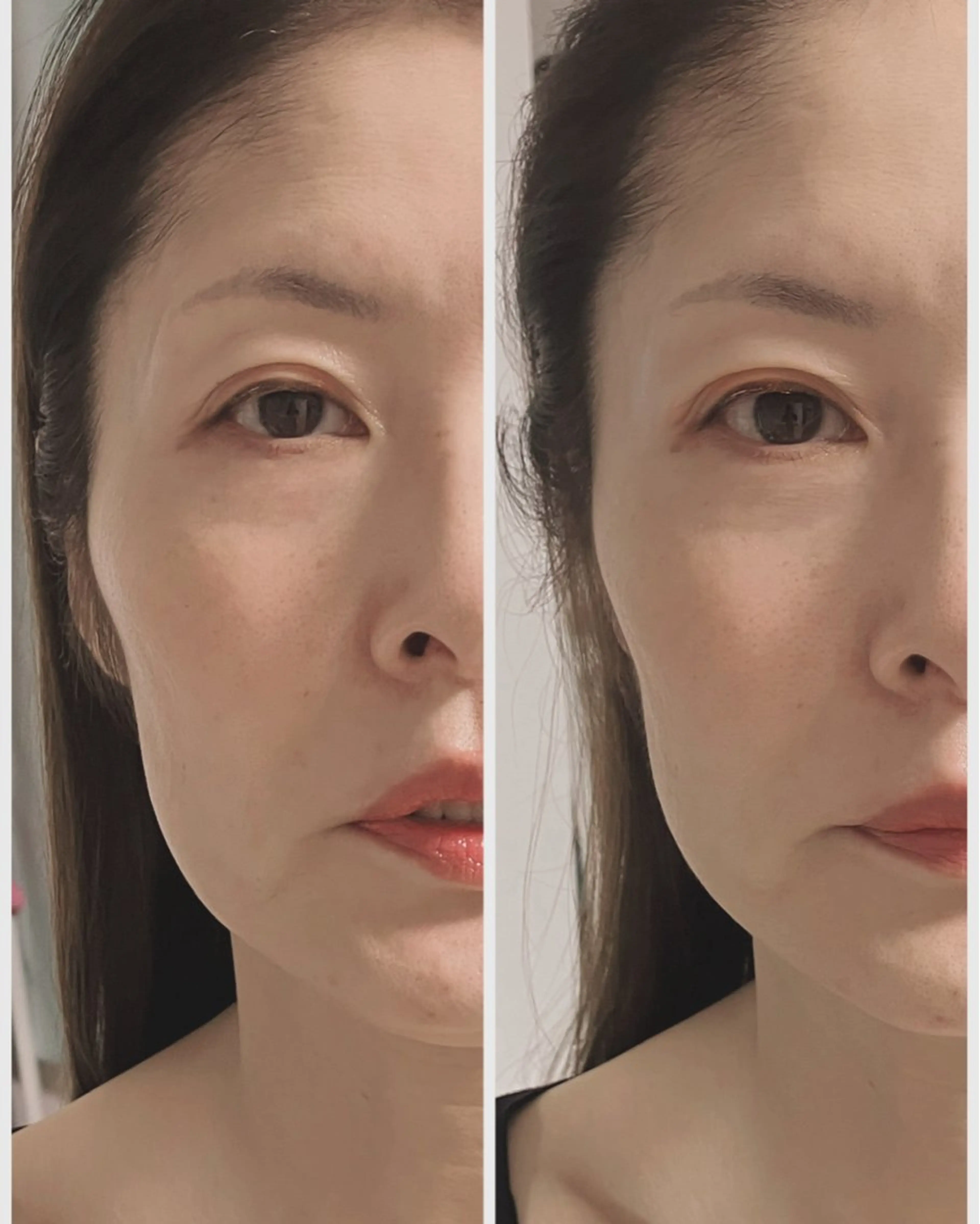 💆‍♀️【30分】小顔リフトアップドライヘッドスパの写真