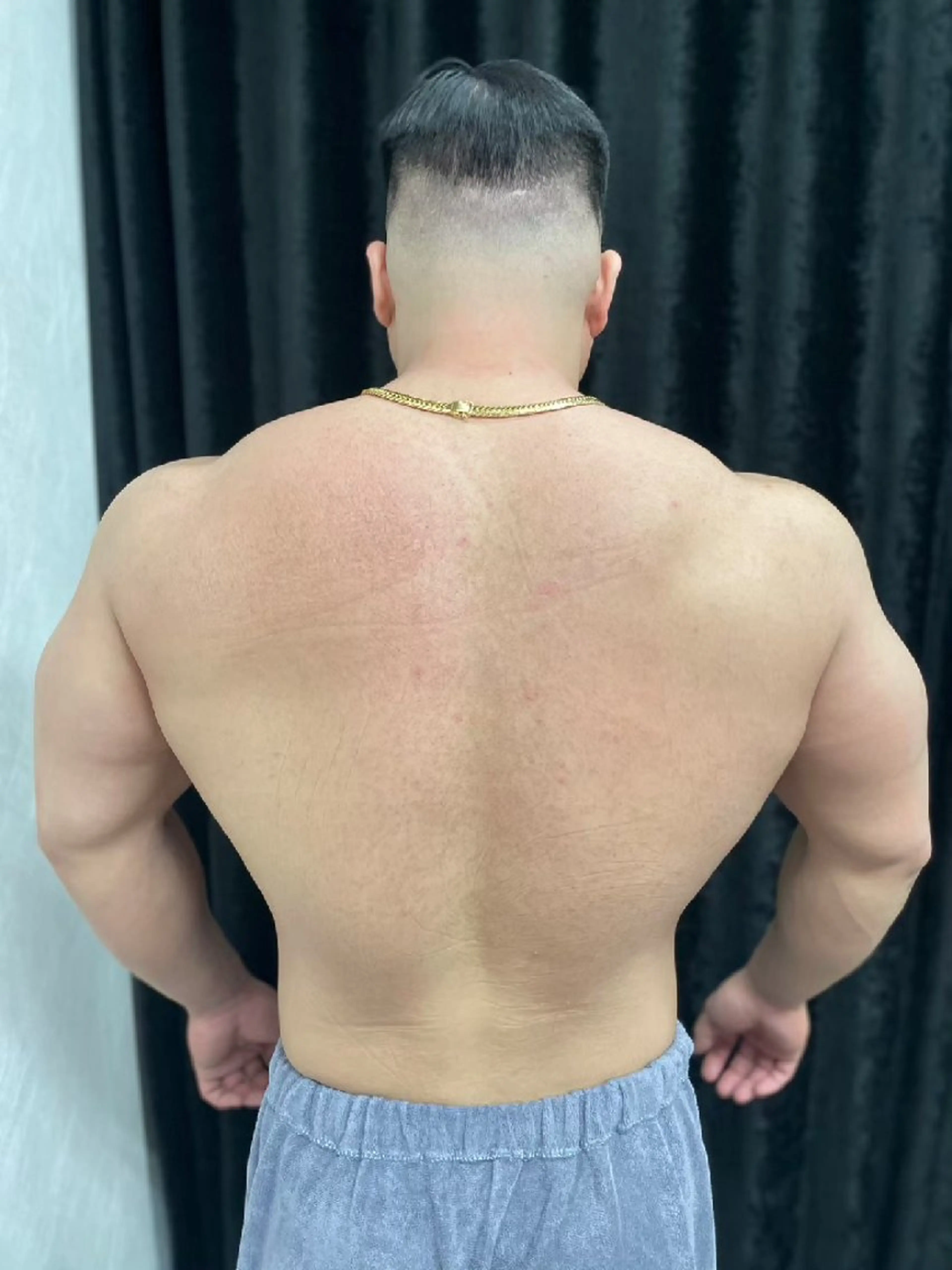 メンズ 脱毛 Reid-月詠-所属・Reid -月詠-のエステ・リラクイメージ