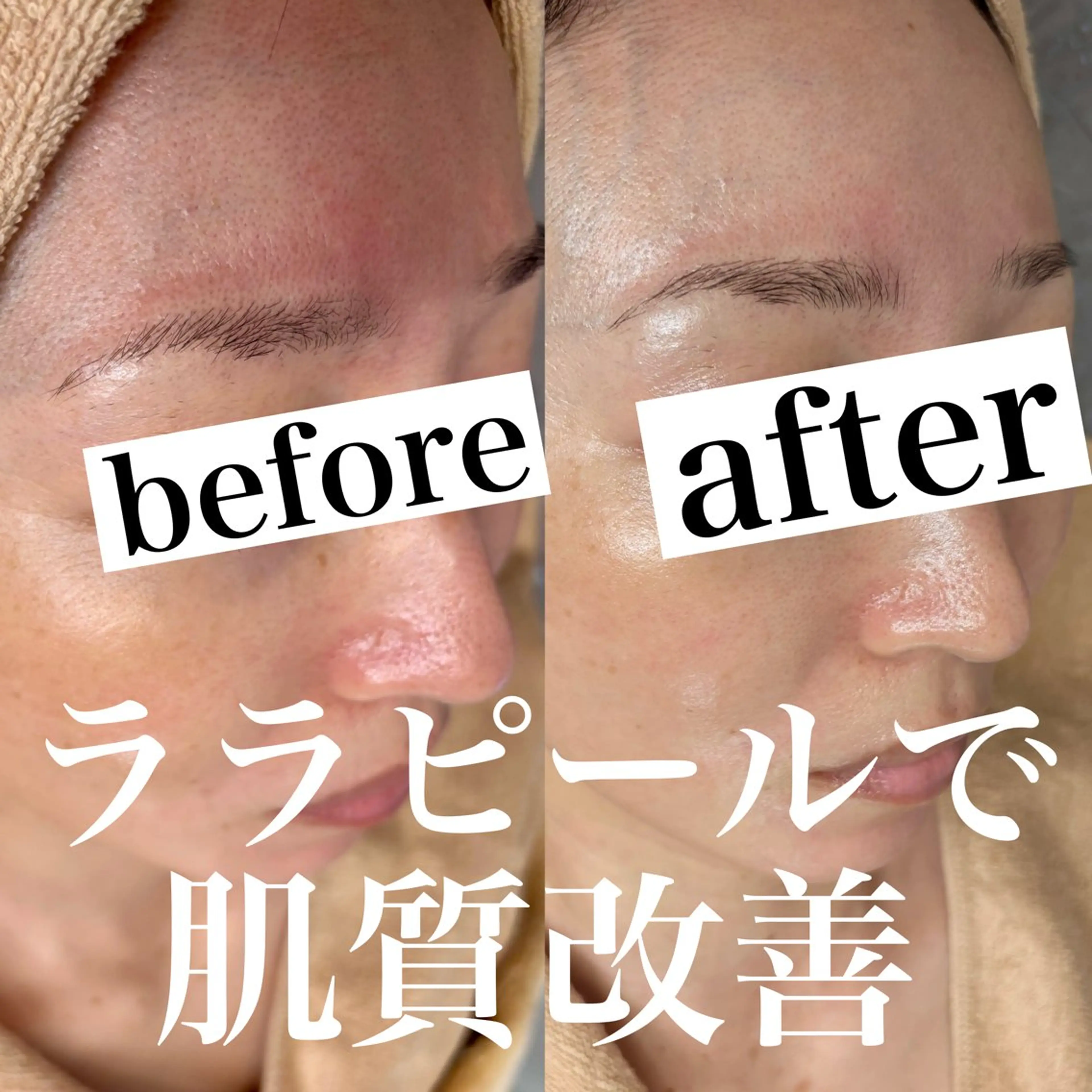 WHITE AQUA 北千住店のエステ・リラクイメージ