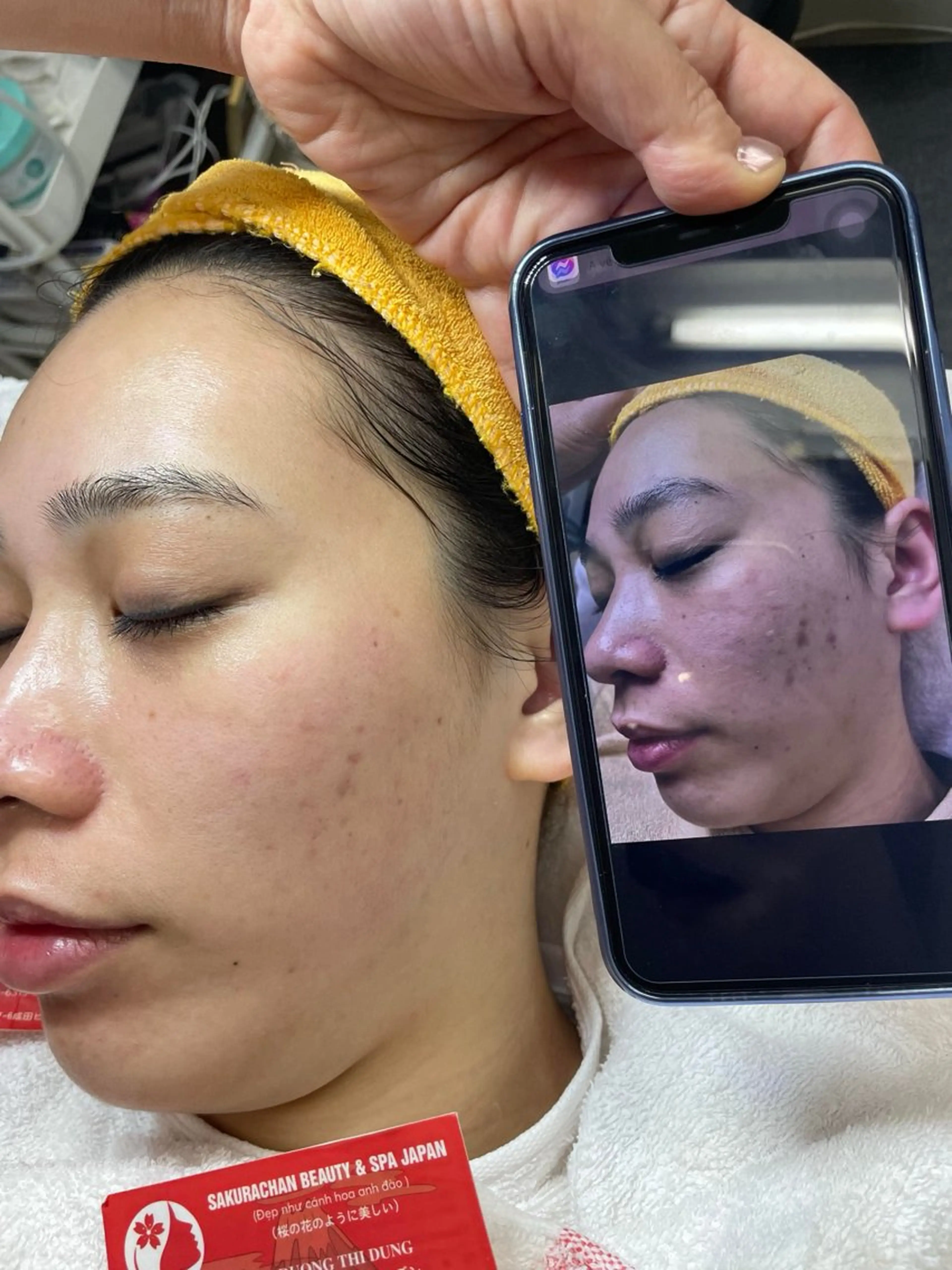 ニキビ、痩身、脱毛、 サクラチャンスパのエステ・リラクイメージ