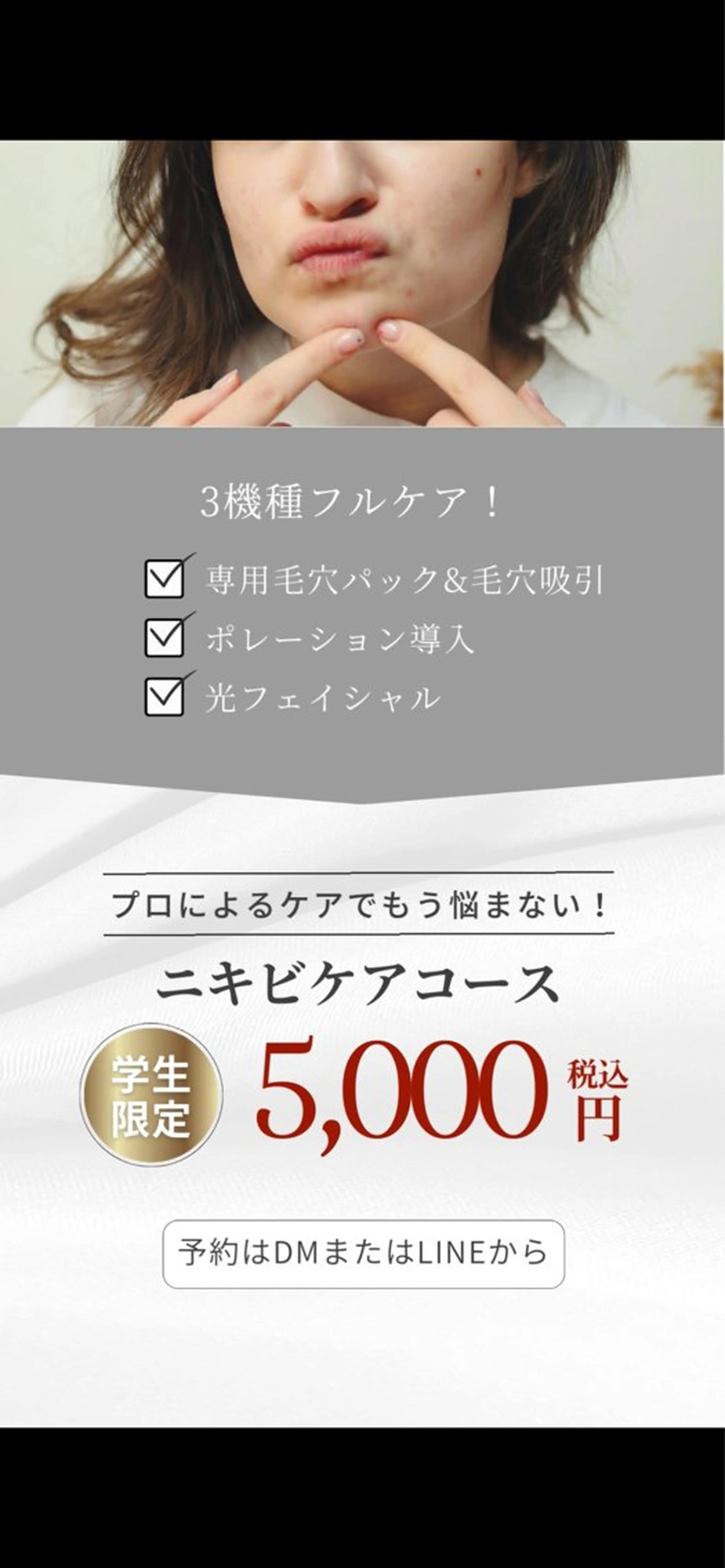 学生限定ニキビケアコースの写真