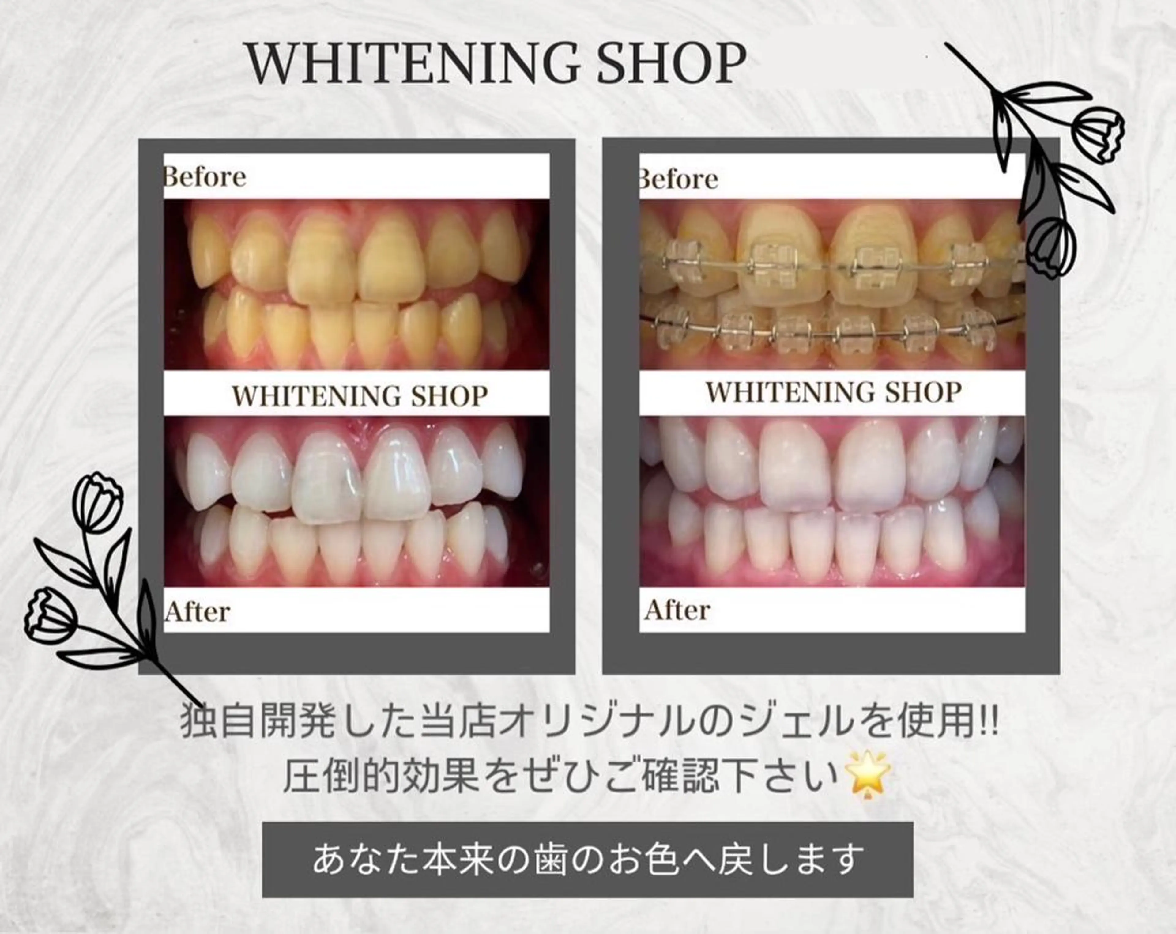 メンズ ホワイトニング ショップ本八幡店のエステ・リラクイメージ