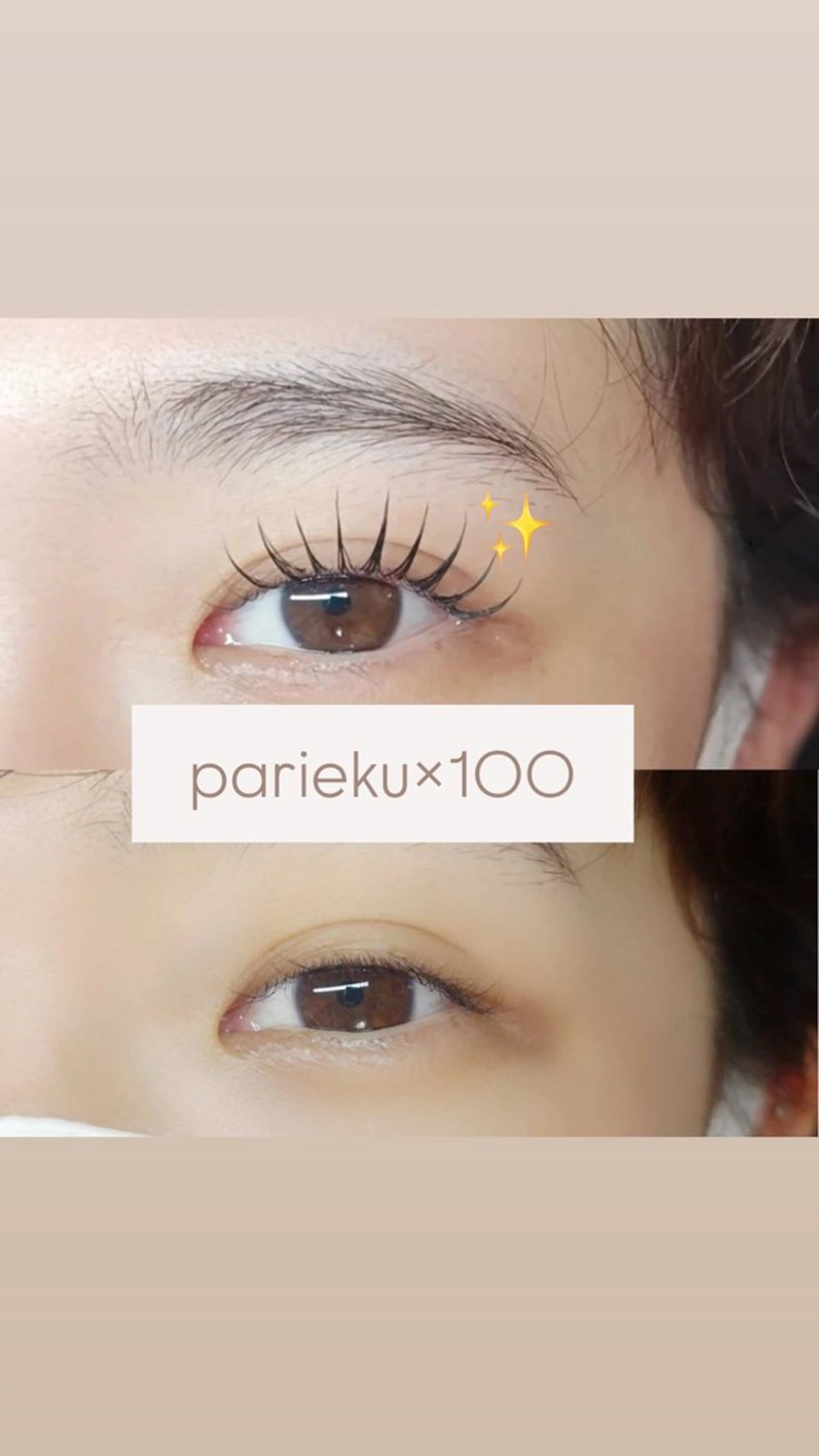🌻8月限定🌻リニューアルオープン✨　　【パリエク100本】の写真