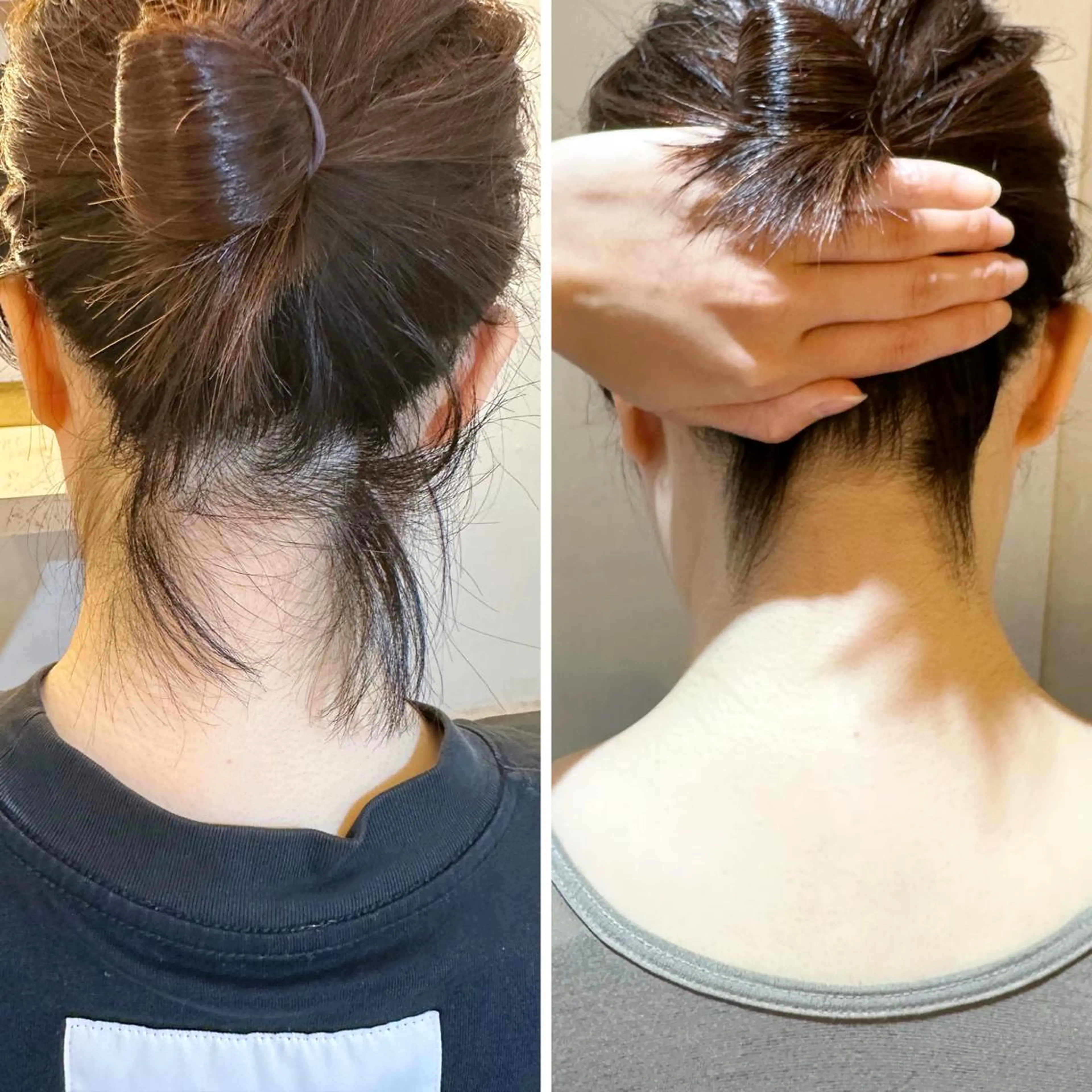 脱毛 うなじ脱毛/美肌脱毛 LABELのエステ・リラクイメージ