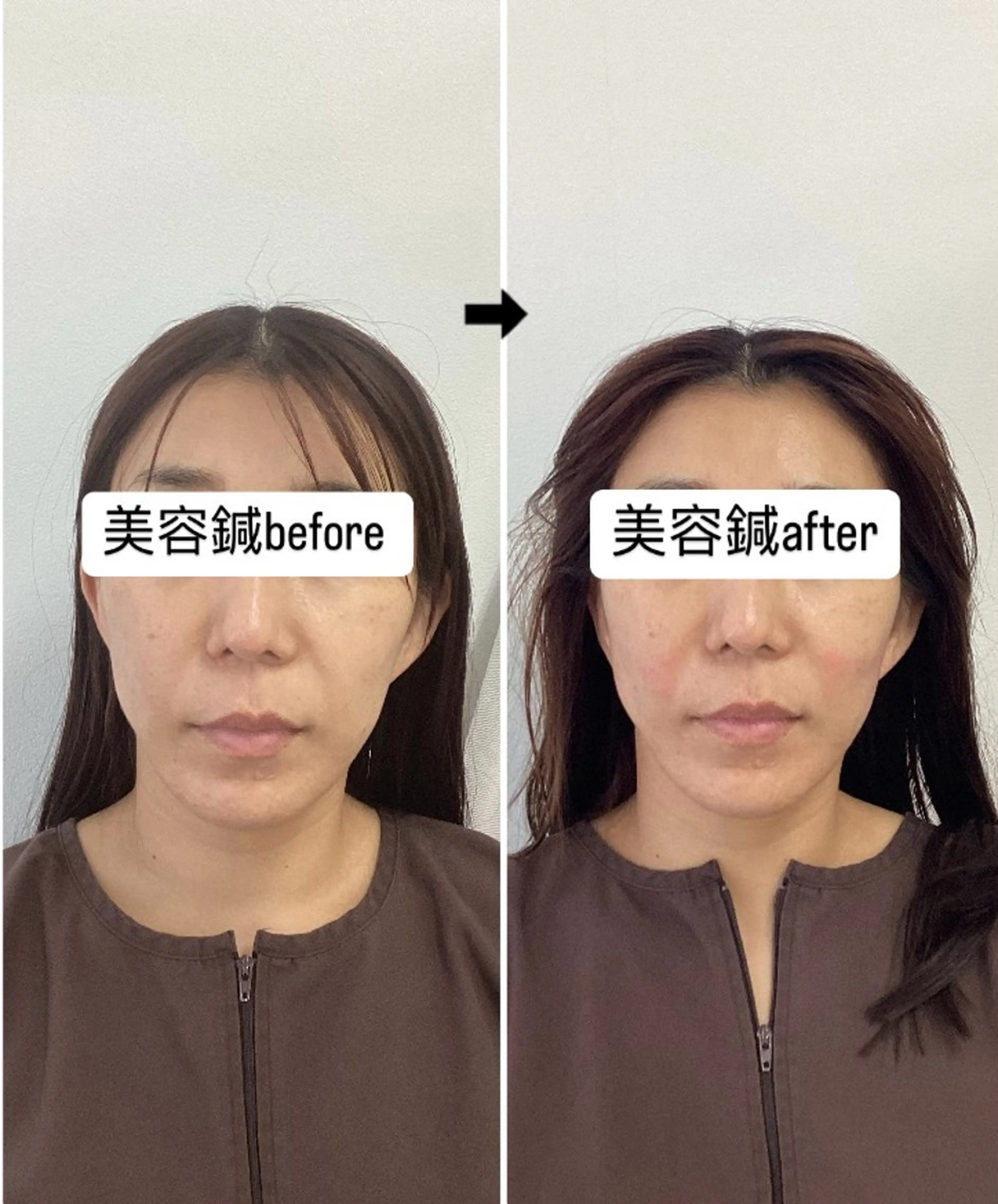 エステ リラク hari salon de off　美容鍼灸×小顔整体【ハリサロンドオフ】所属・美容鍼×小顔整体🤍 ishibashiのエステ・リラクイメージ