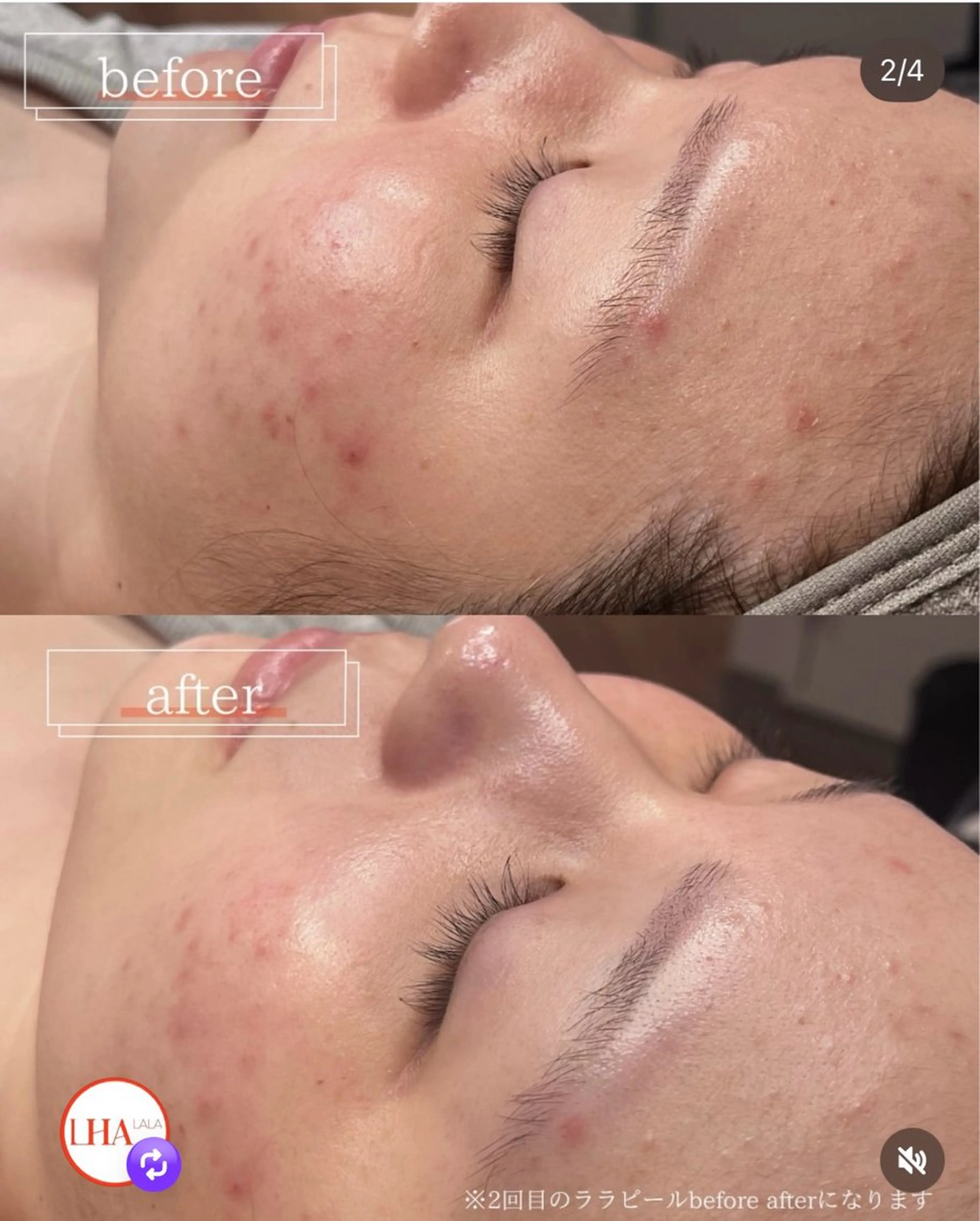 エステ YUIITSU所属・YUIITSU 唯一のエステ・リラクイメージ