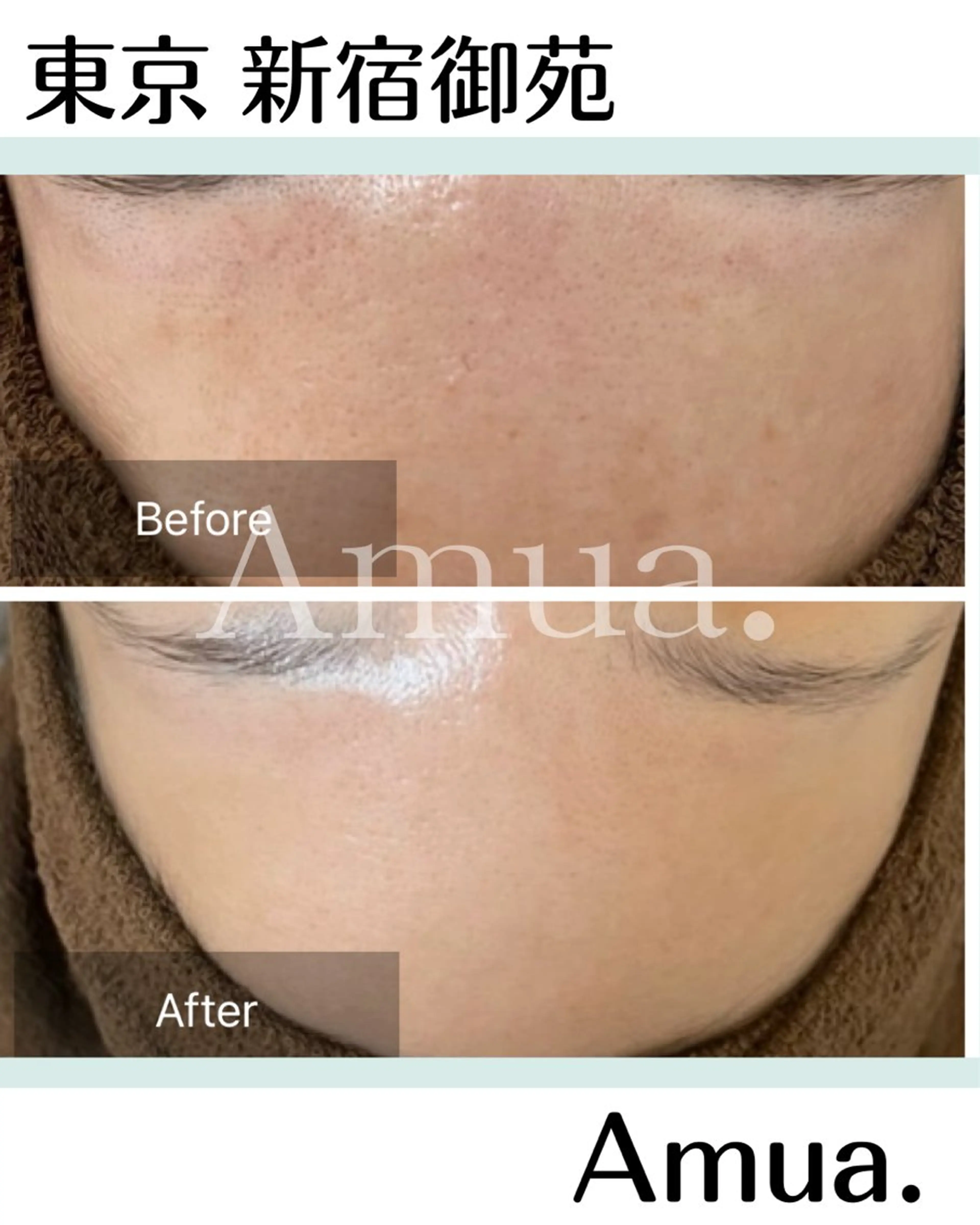 エステ Amua.facial salon所属・Amua.ハーブ 新宿御苑駅前のエステ・リラクイメージ