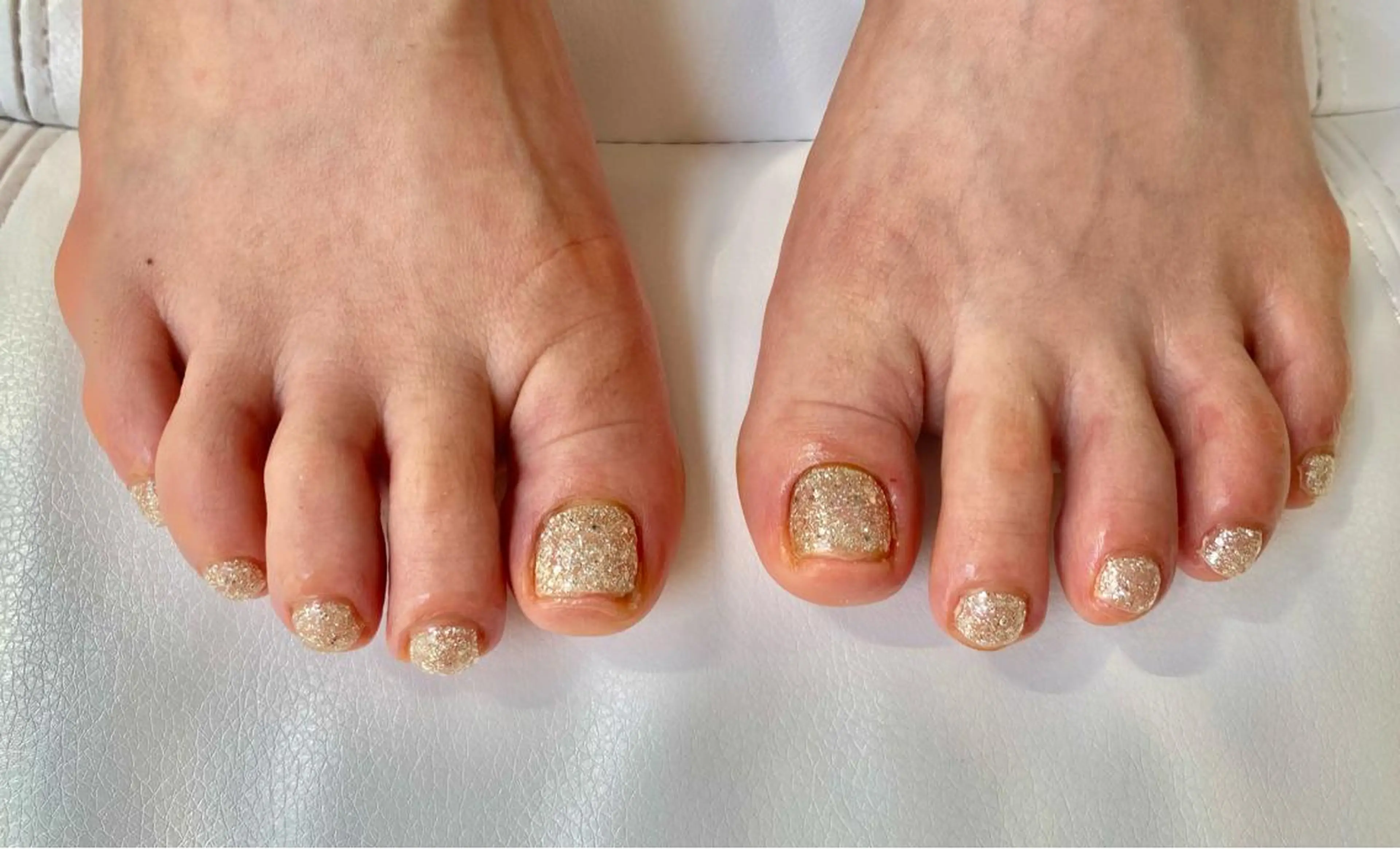 ネイル フットネイル Renatus Nailのネイルデザイン