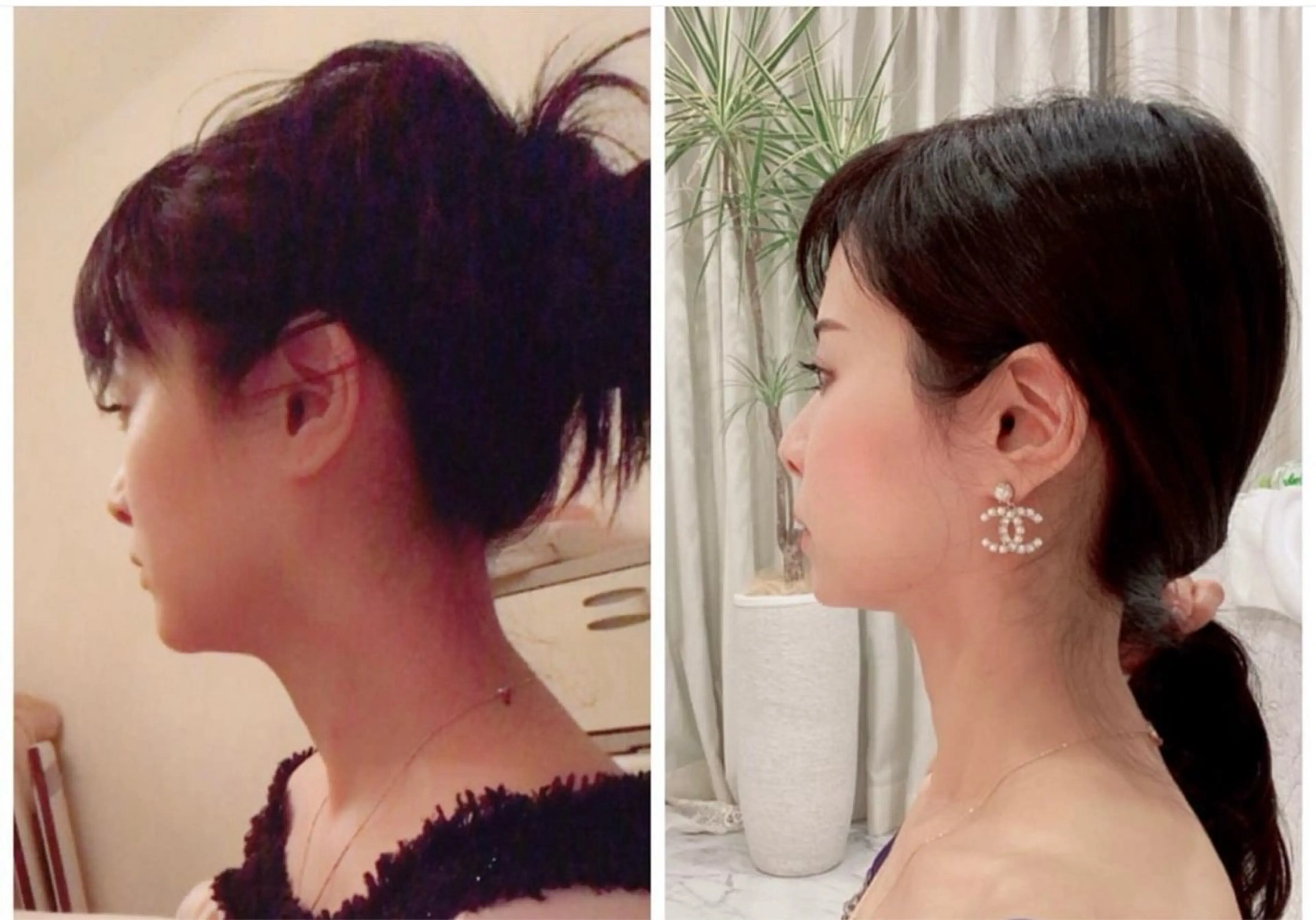 ブライダル💒美禅筋骨小顔トリートメント🩷ヒト幹細胞でのマッサージ💆‍♀️お顔、鎖骨デコルテや二の腕、背中周りも😃の写真