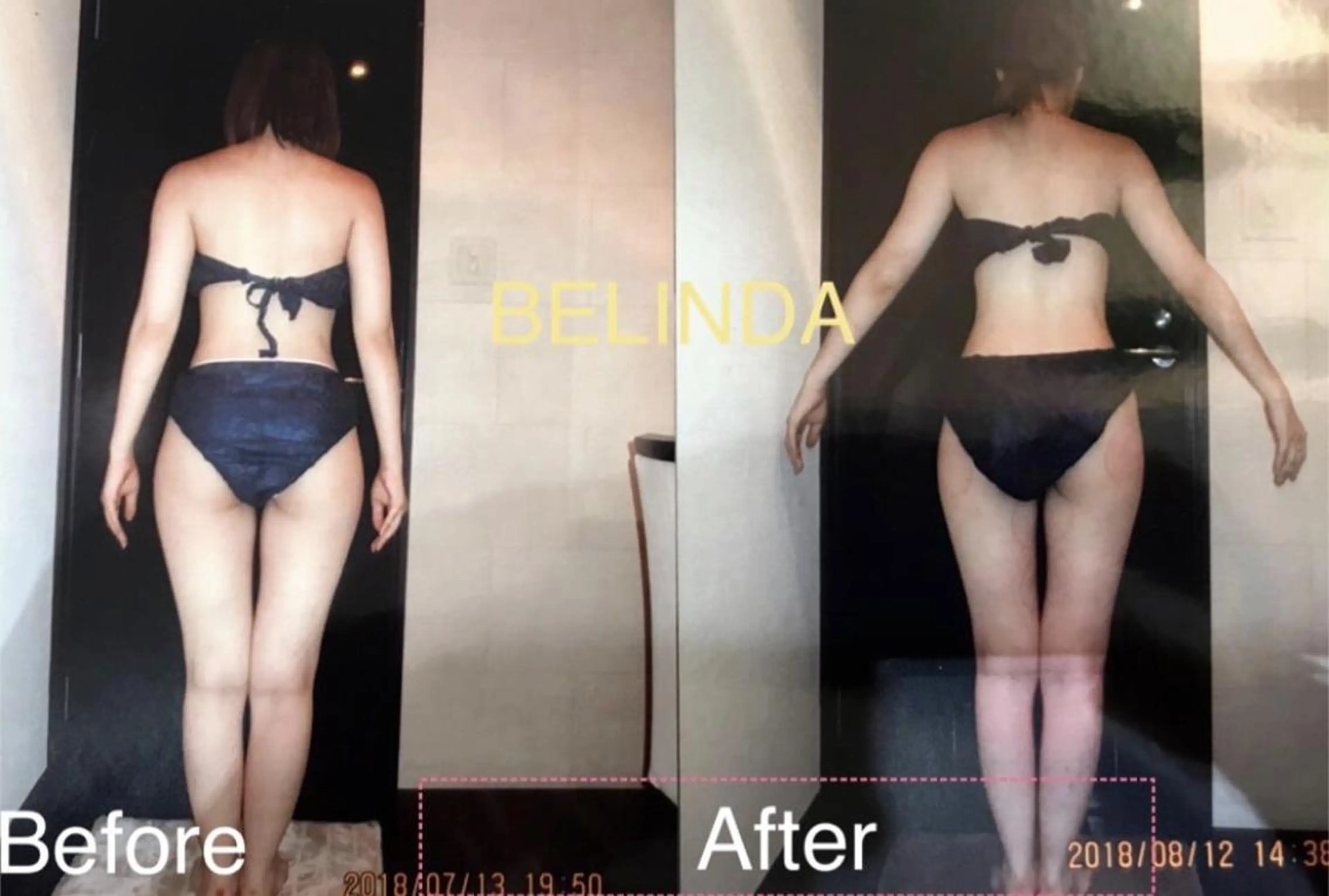 エステ BELINDA銀座店 ✨痩身エステサロン✨のエステ・リラクイメージ