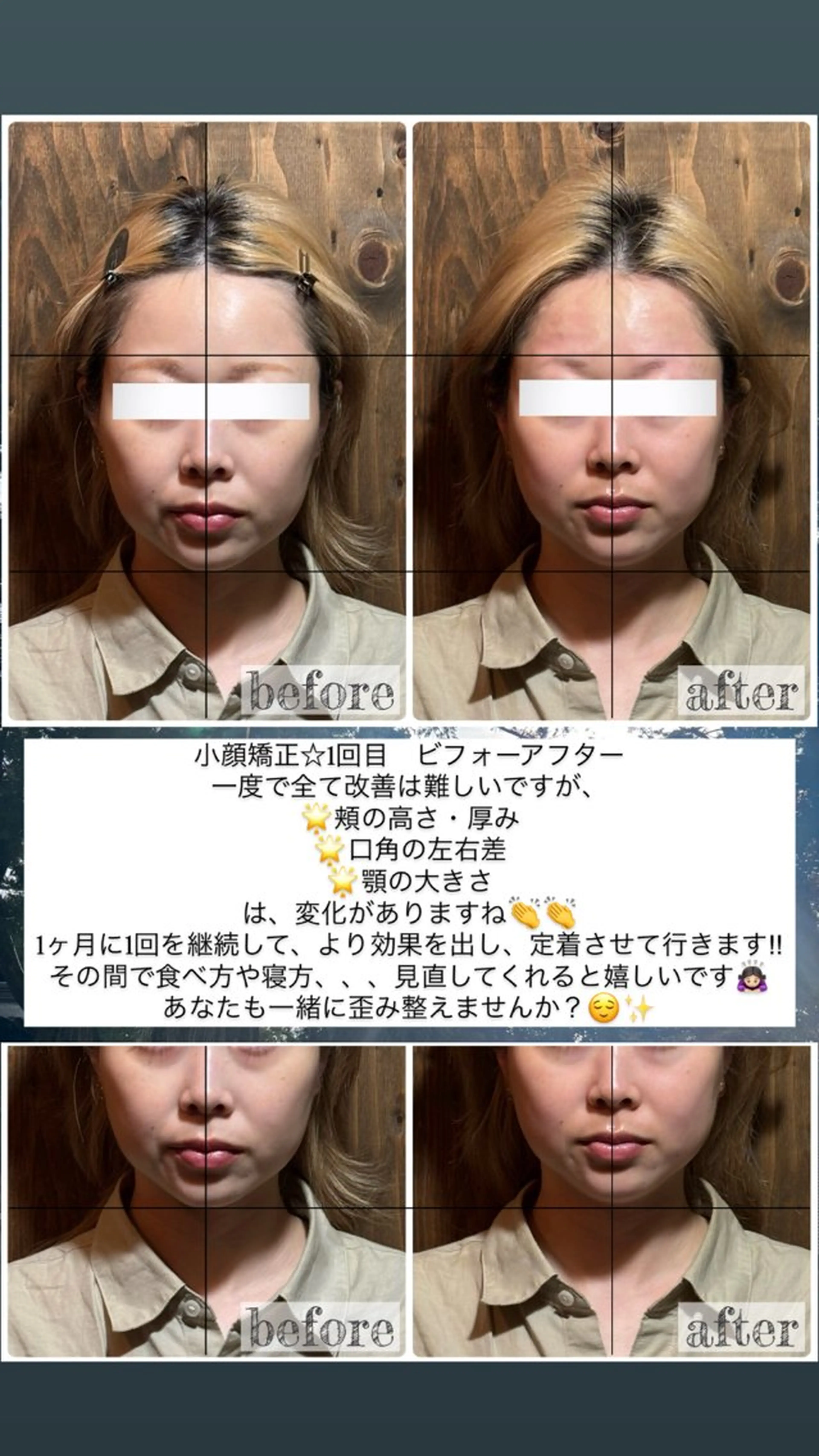 エステ リラク 💎後悔させない小顔 矯正💎イトヤマ🌱のエステ・リラクイメージ