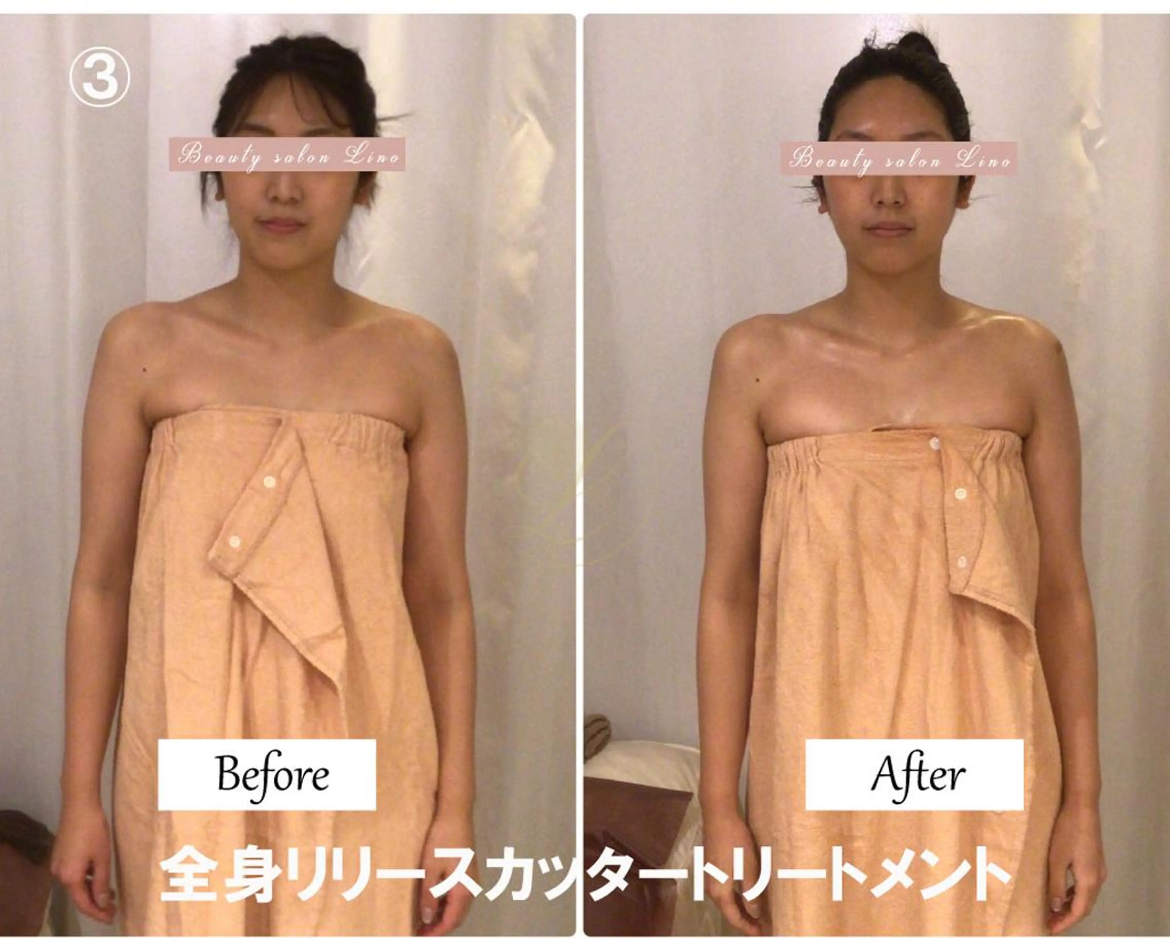 肩こり改善 筋膜リリースカッターのエステ・リラクイメージ