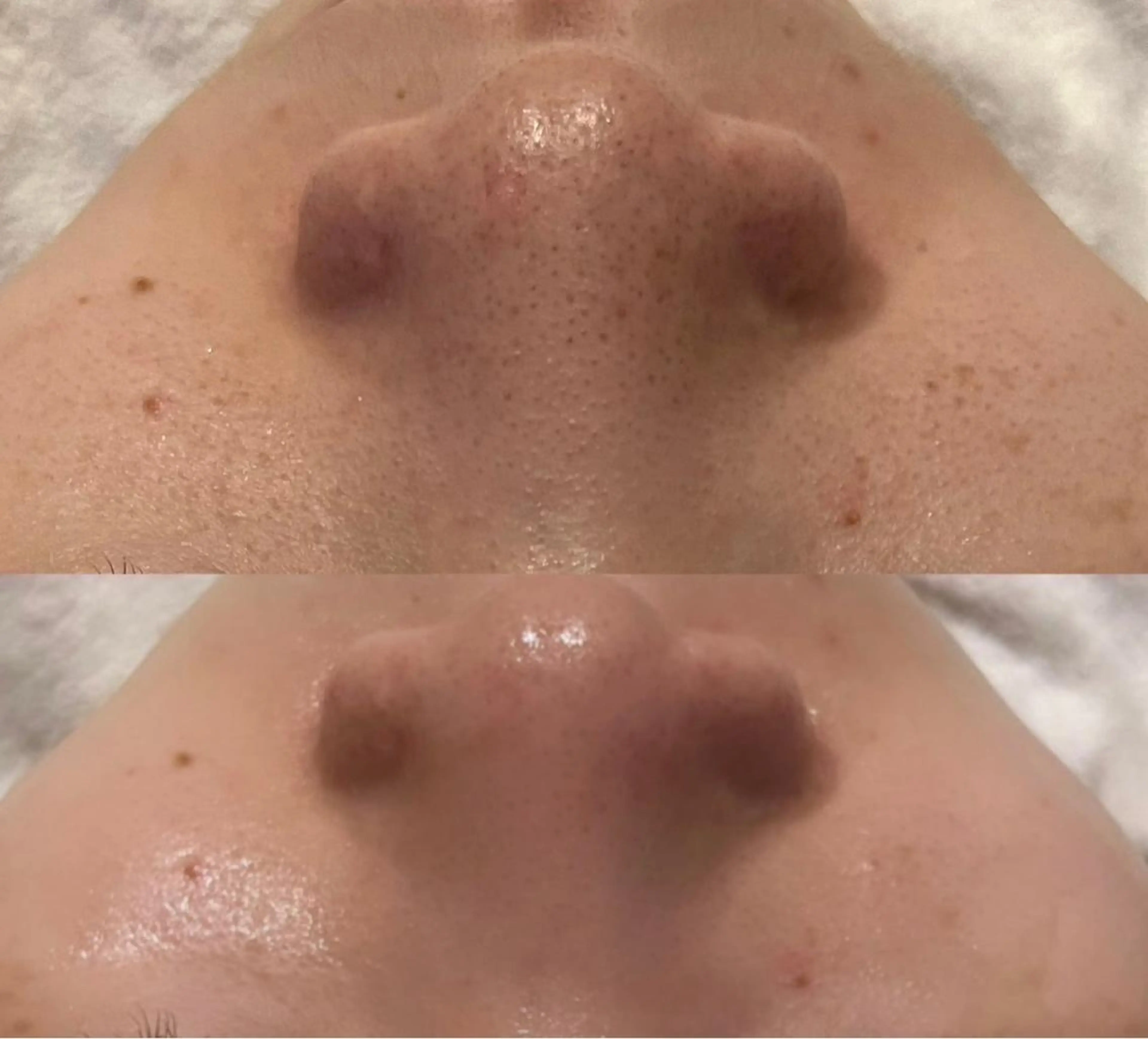 凛とひらくデコルテ Spa　“koti”のエステ・リラクイメージ
