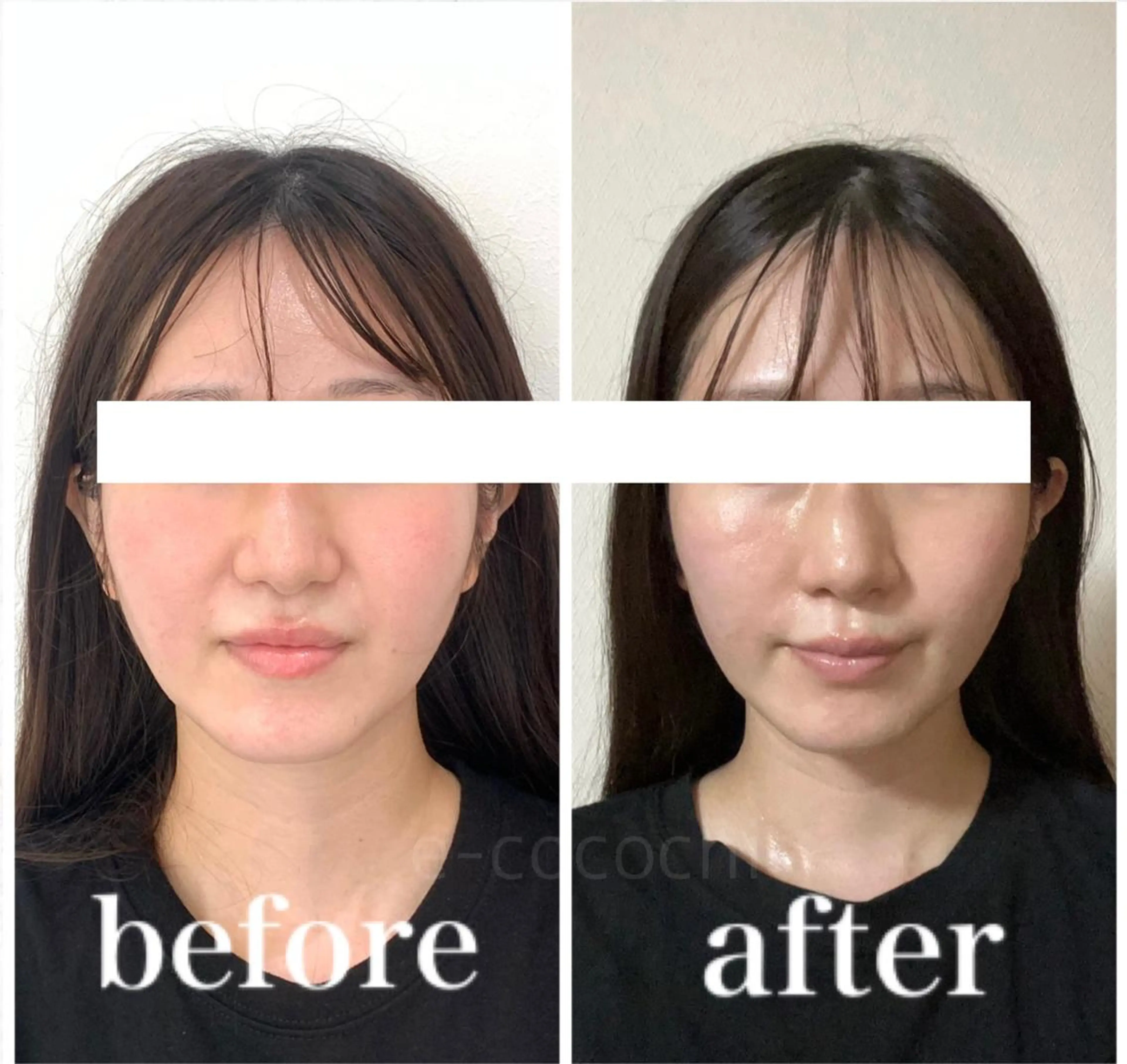 エステ リラク 小顔と ヘッドスパのお店のエステ・リラクイメージ