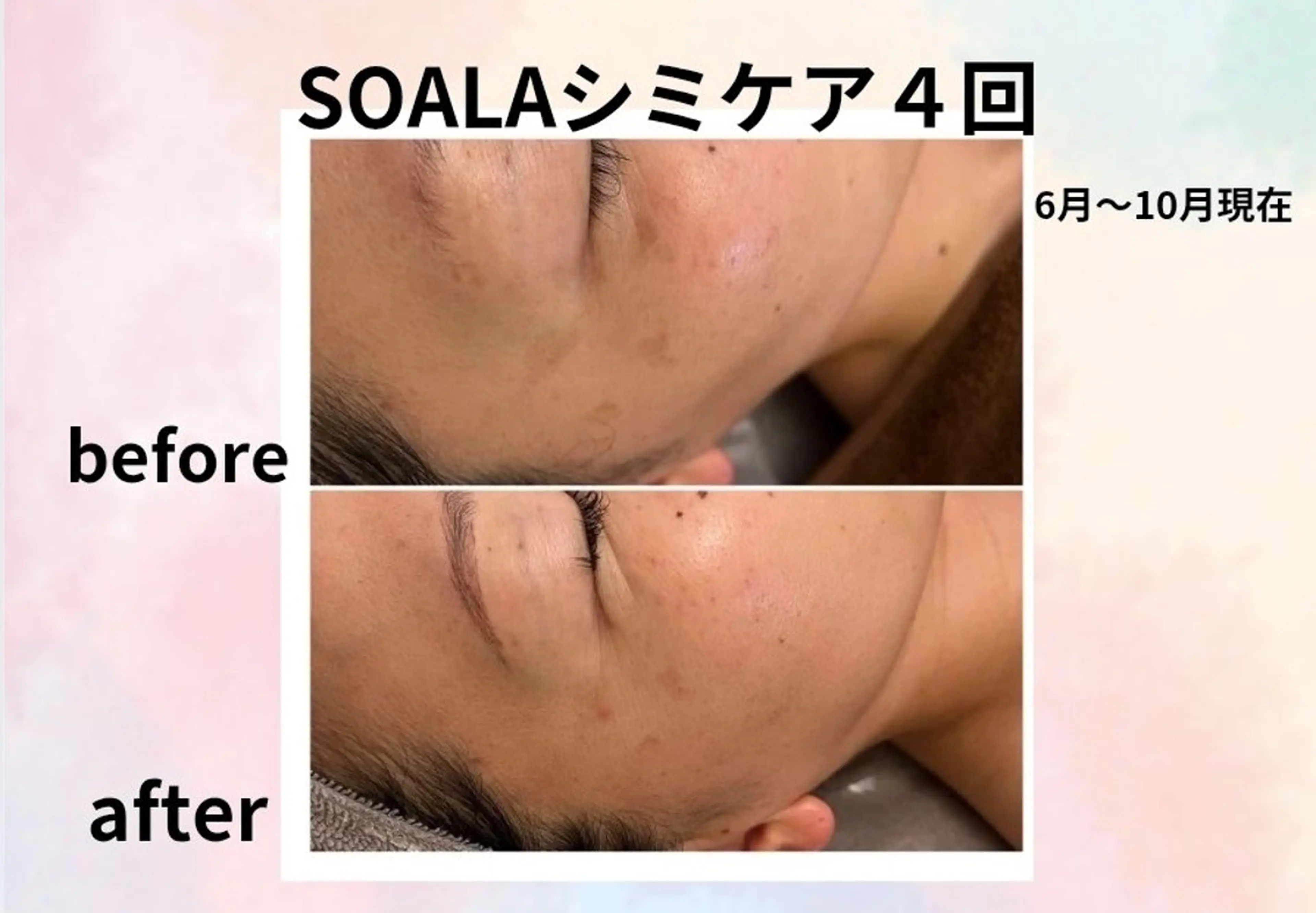 エステ 美容整体師  江上のエステ・リラクイメージ