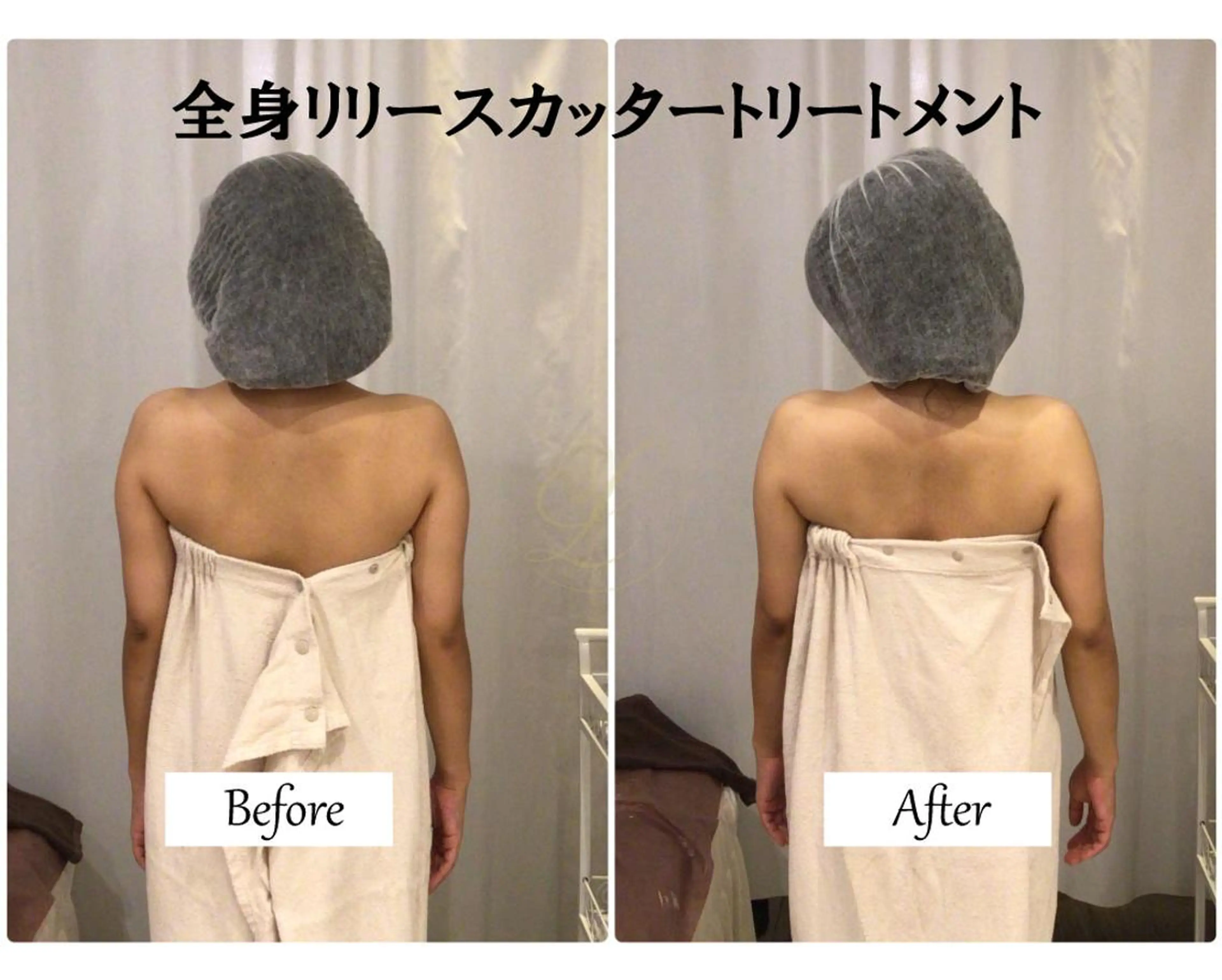 エステ リラク 肩こり改善 筋膜リリースカッターのエステ・リラクイメージ
