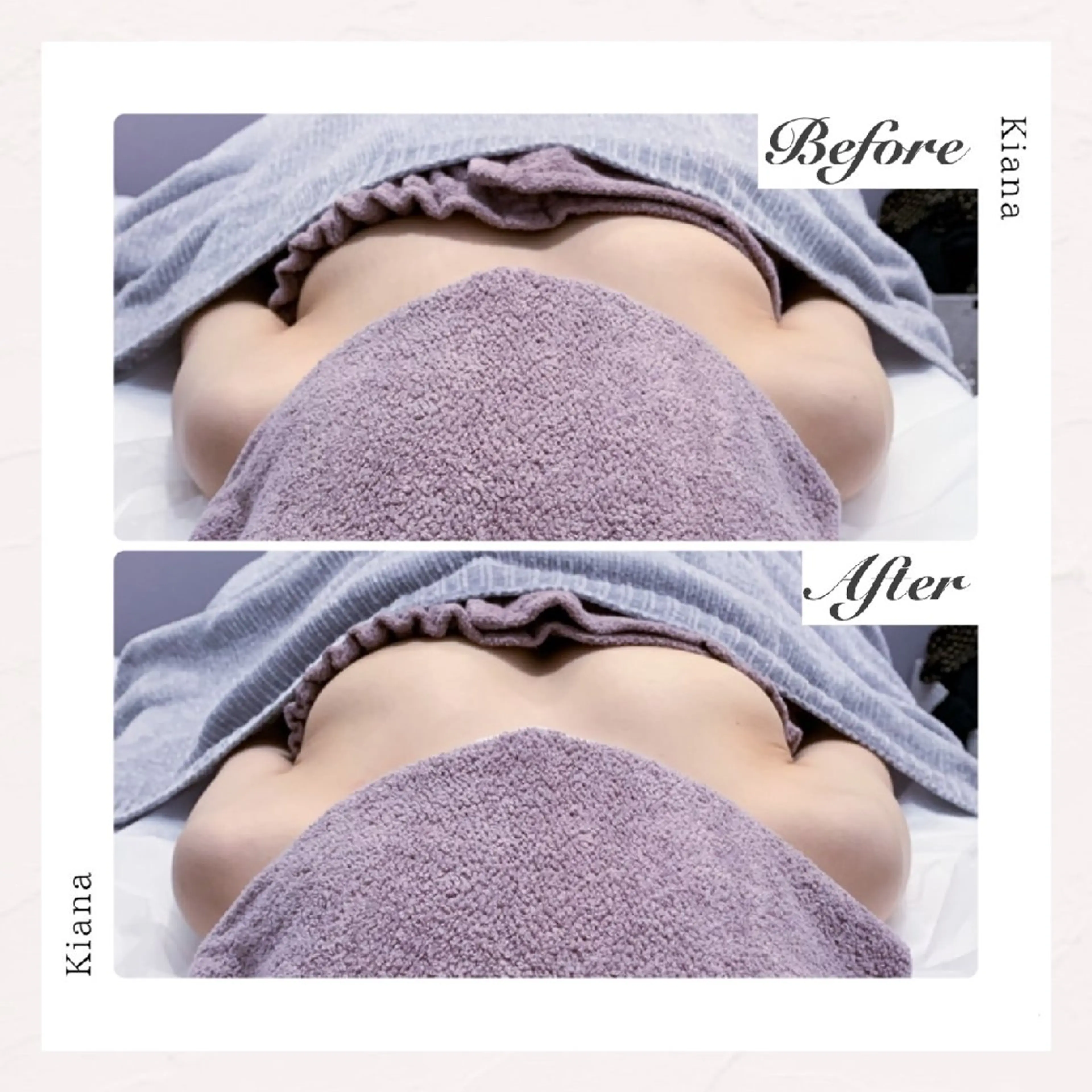 【バスト専門店 】 Kiana のエステ・リラクイメージ