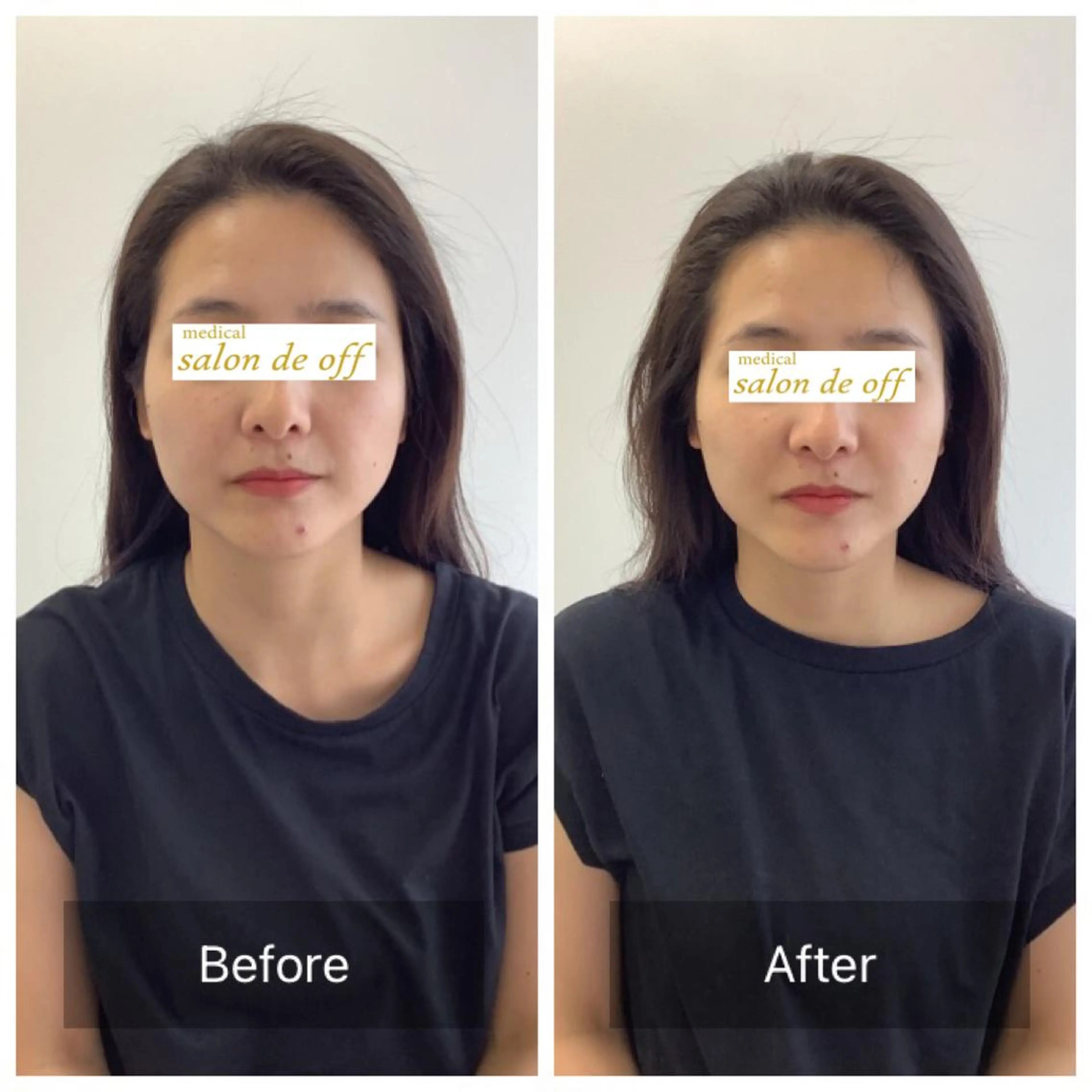 メディカルサロンドオフ所属・ハリサロンドオフ 美容鍼灸×小顔整体のエステ・リラクイメージ