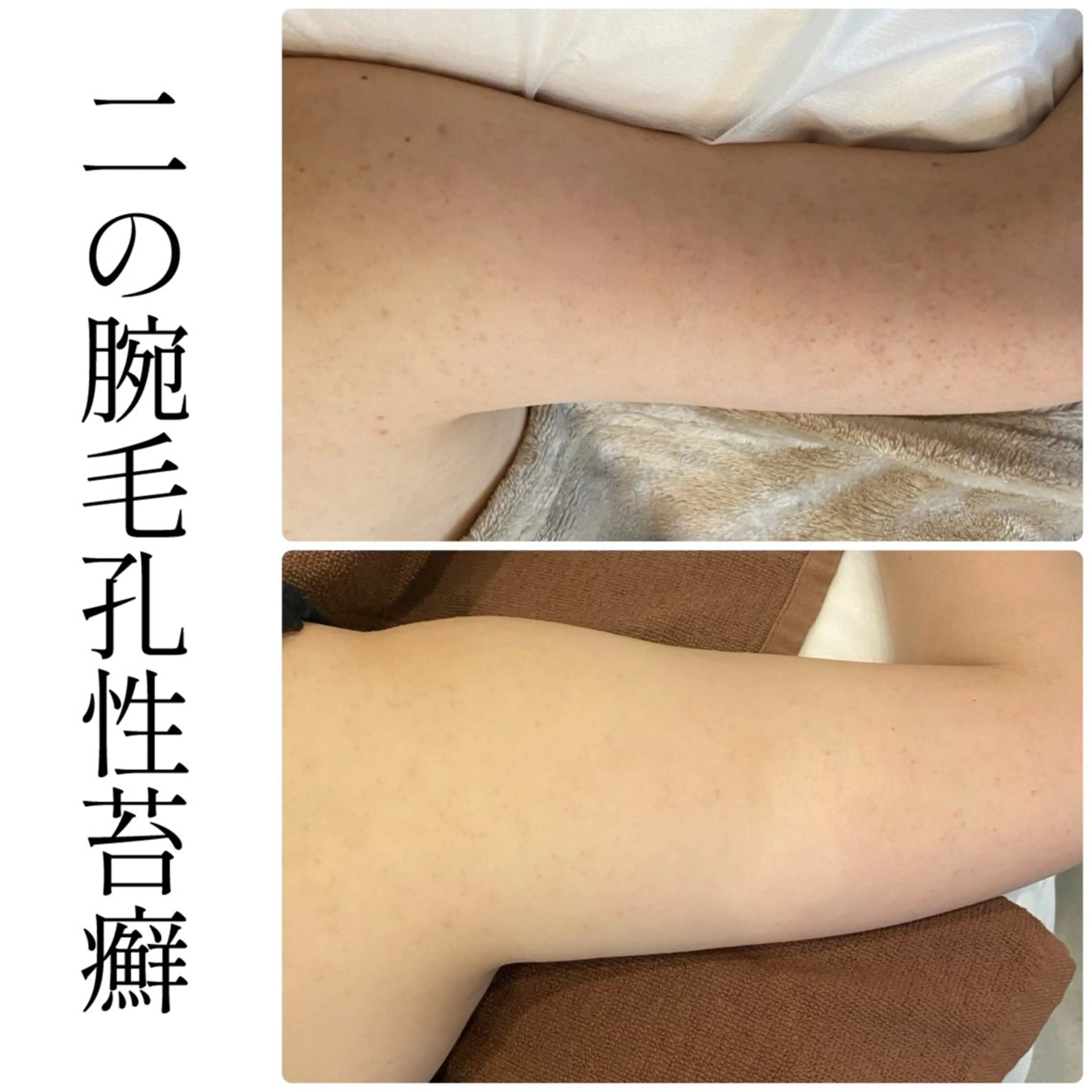 ハーブピーリング専門 BIOEL横浜のエステ・リラクイメージ