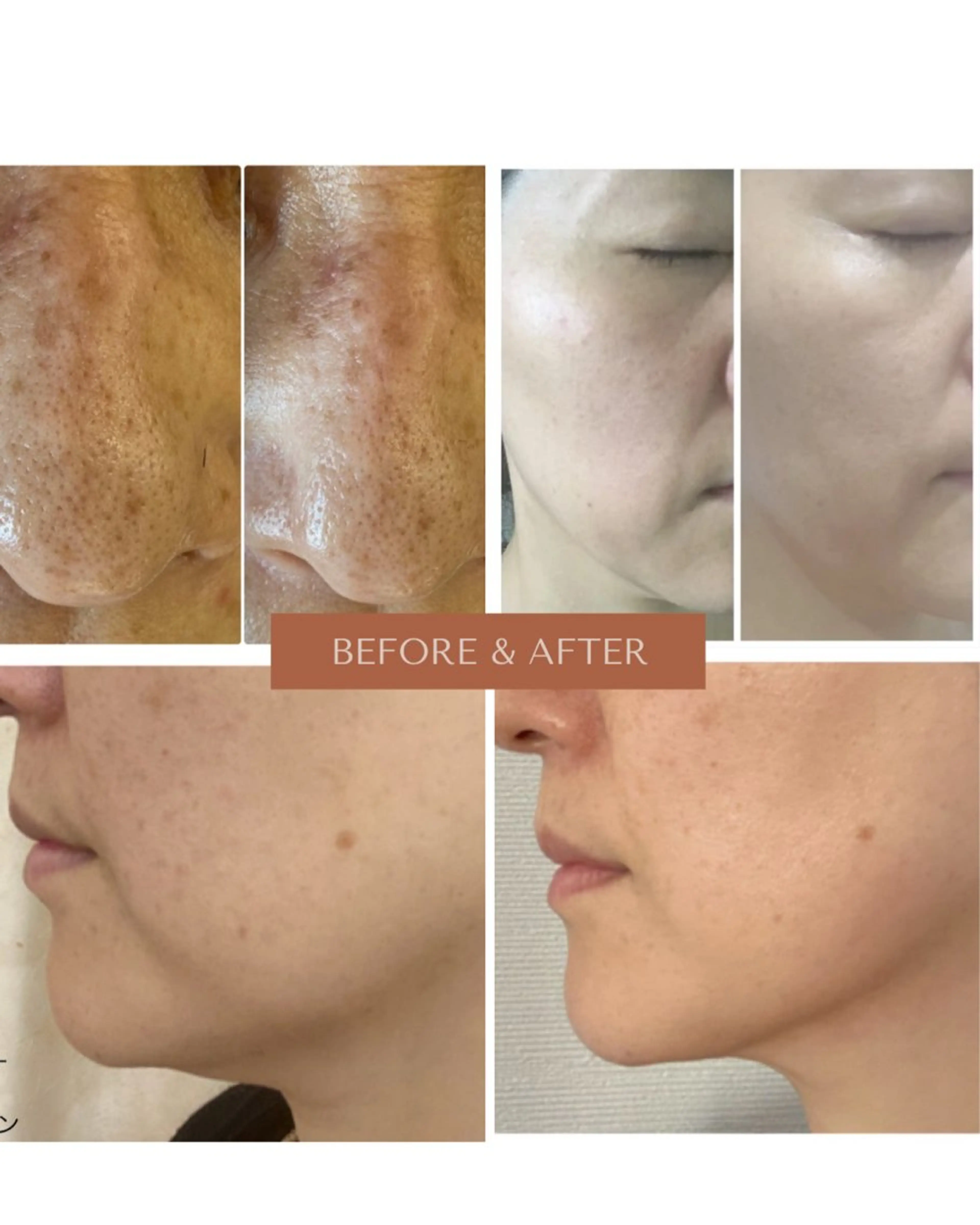 エステ healthy&beauty DEWA所属・healthy& beautyDEWAのエステ・リラクイメージ