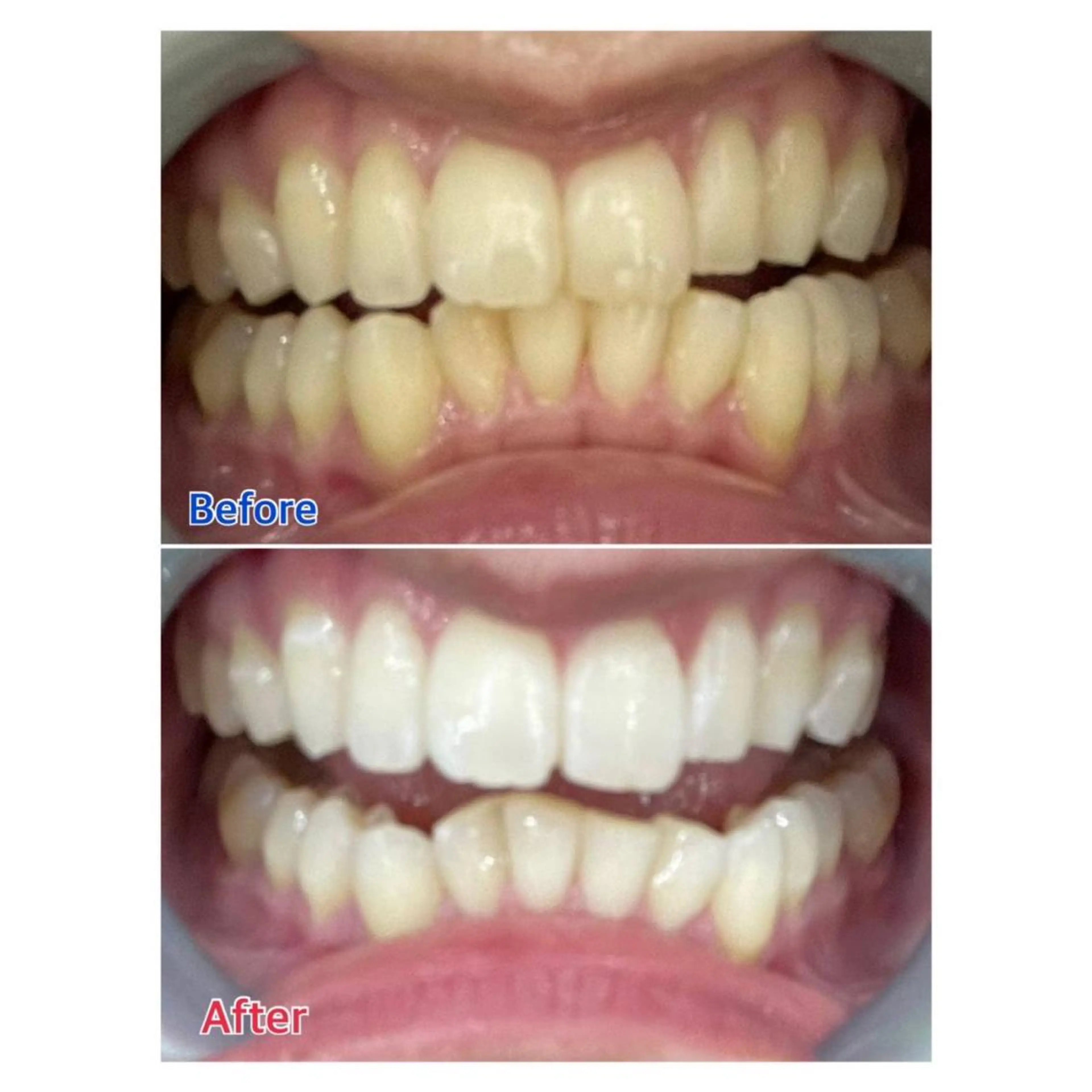 MBEAUTYSALON 千葉店・京成大久保所属・Melty 輝のその他イメージ