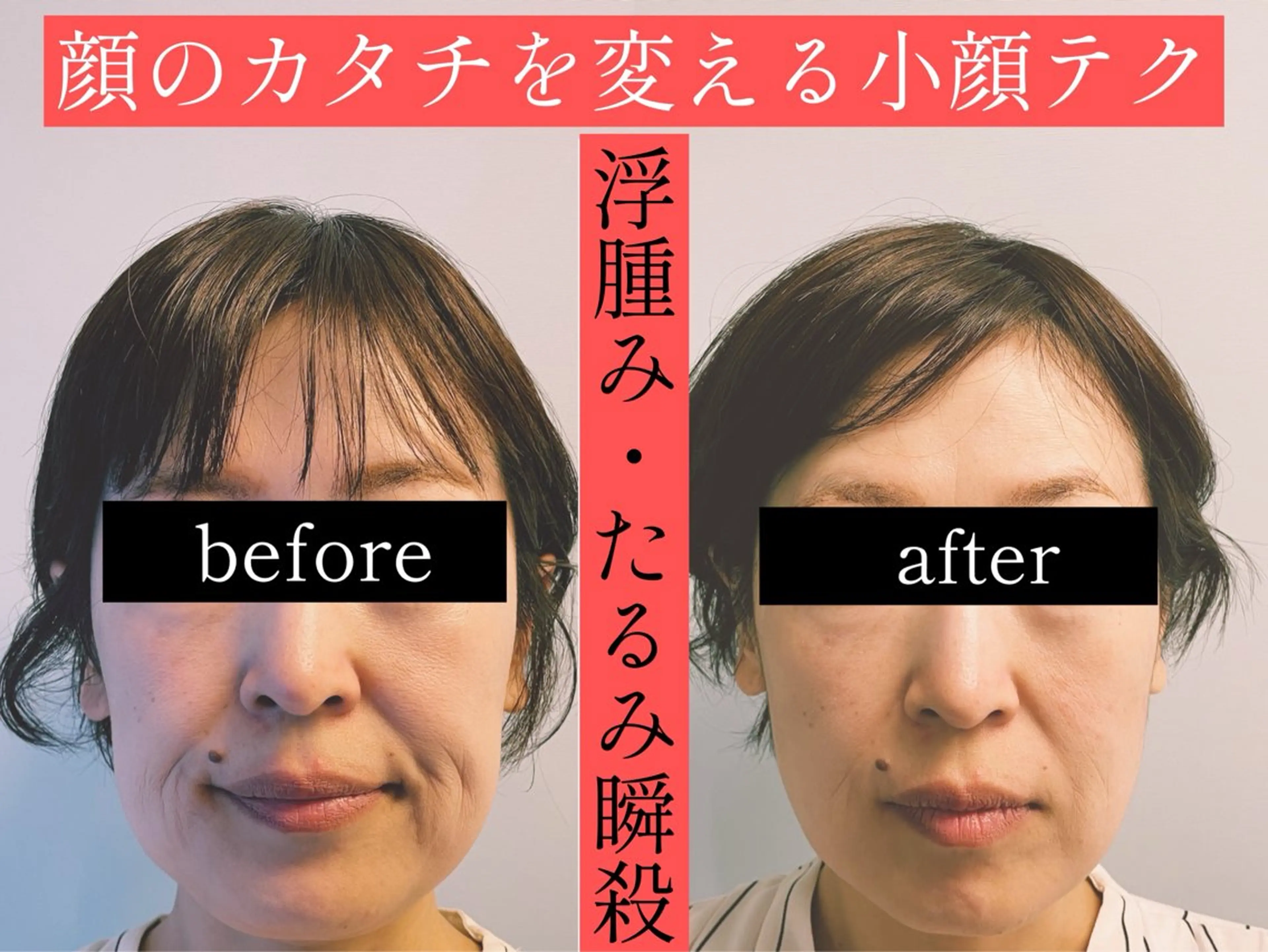 エステ リラク 小顔美容鍼専門サロン 渋谷YZのエステ・リラクイメージ