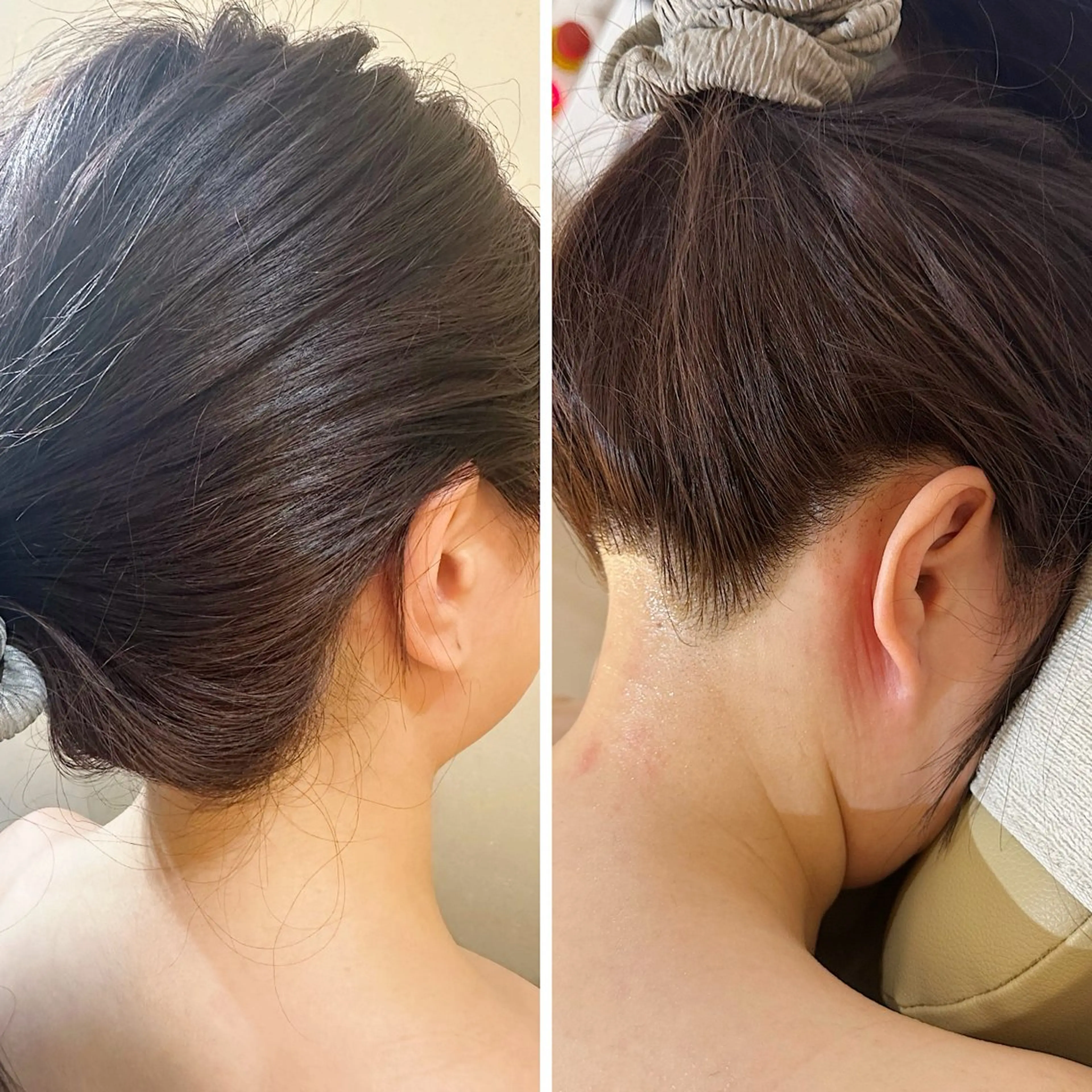 脱毛 うなじ脱毛/美肌脱毛 LABELのエステ・リラクイメージ