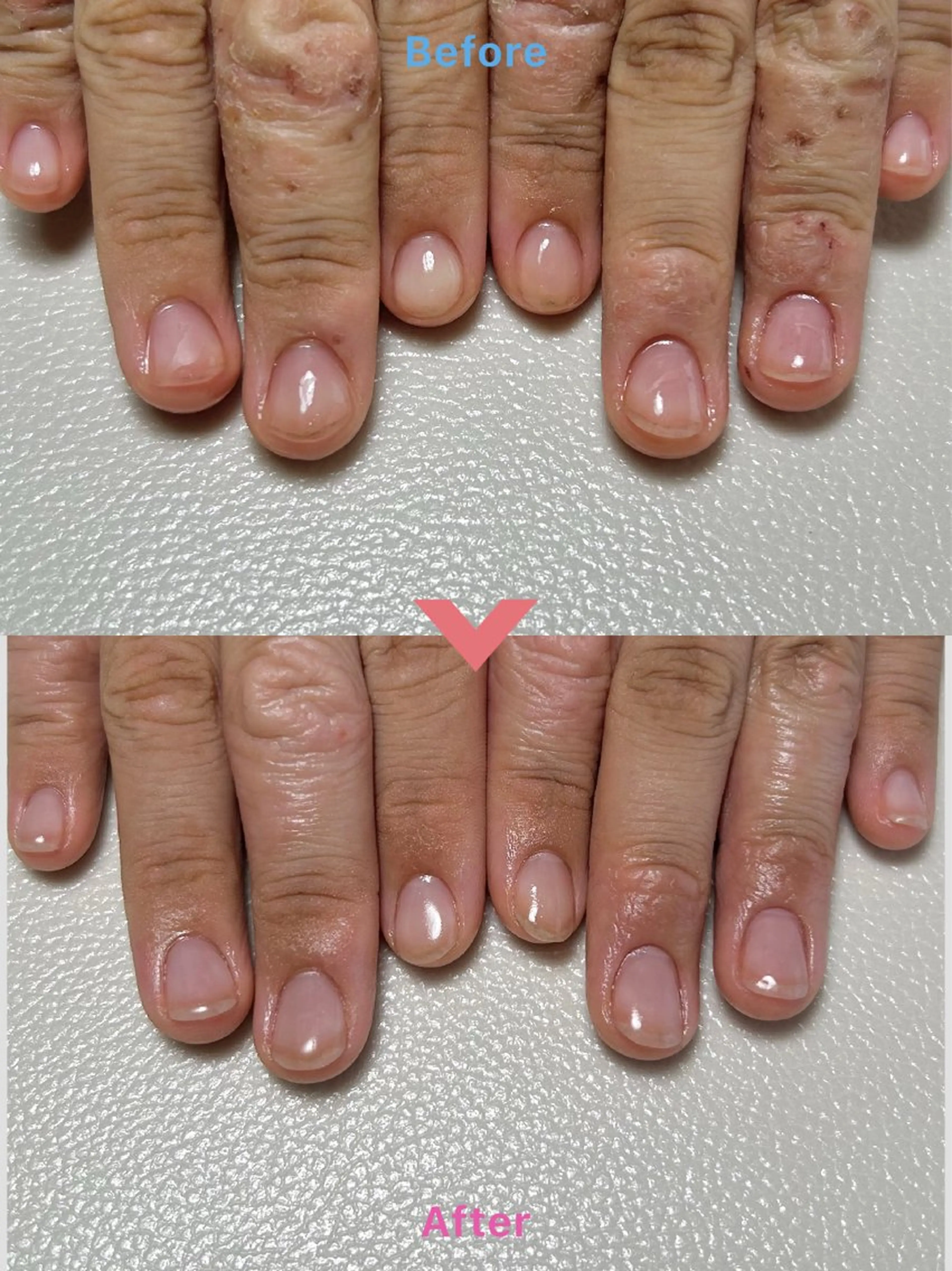 自爪育成メニュー🌿弱酸性ジェルで爪に優しい🌿ジェル有り✨おためし　おひとり様初回1回限りの写真