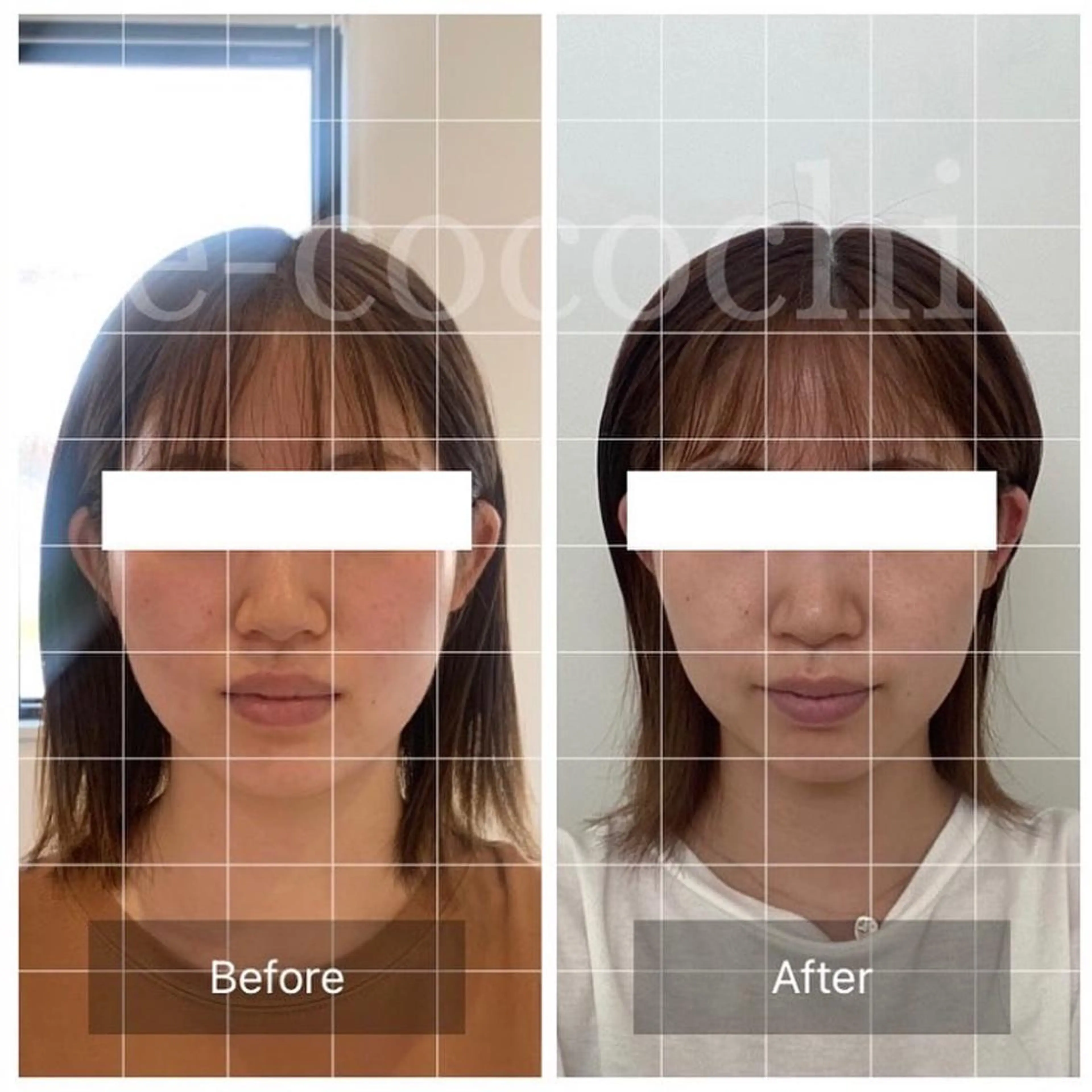 エステ リラク 小顔と ヘッドスパのお店のエステ・リラクイメージ