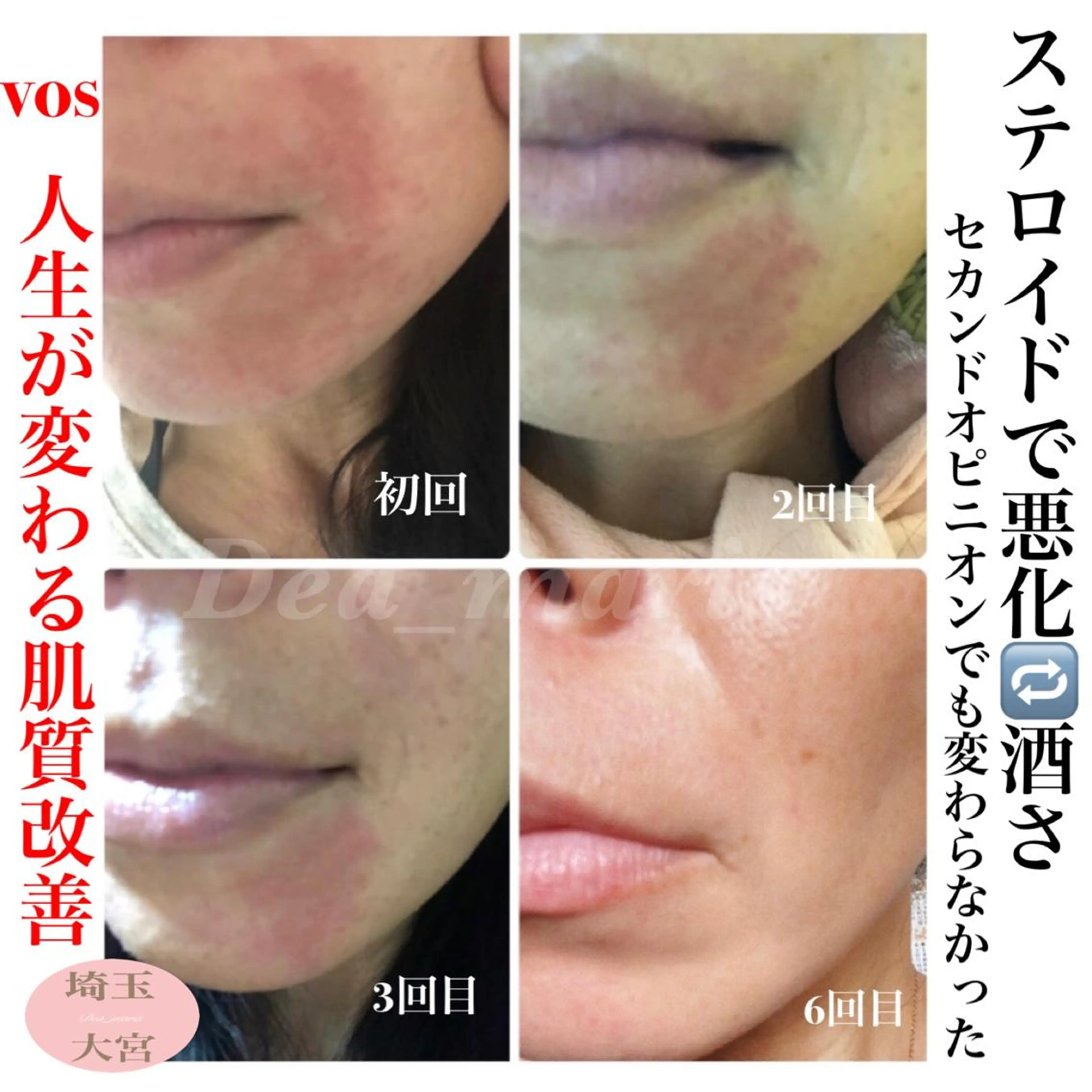 private salon Dea_maris シュガーリング&パーソナルボディケア所属・シミ改善・韓国肌管理 ボディメイク痩身のその他イメージ