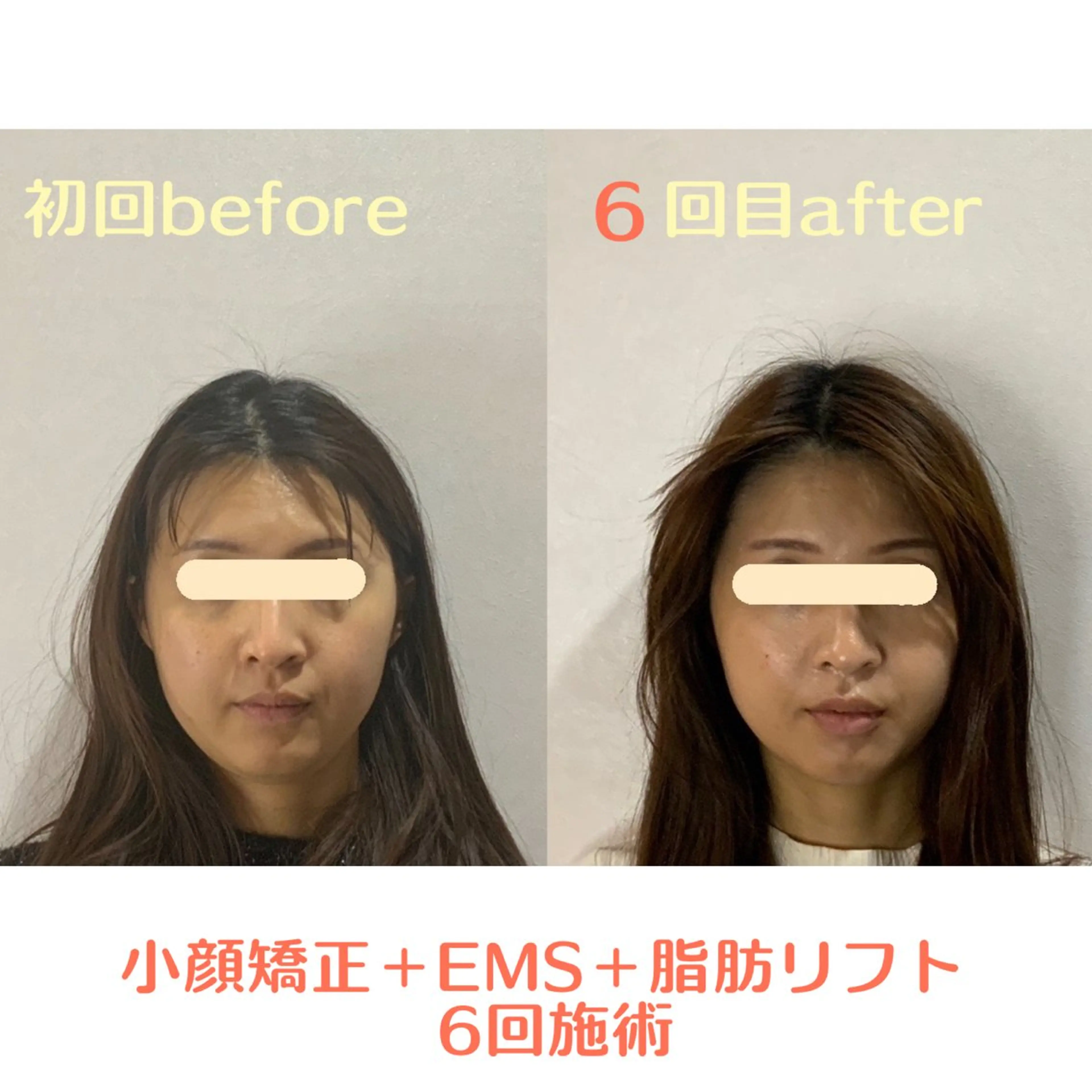 エステ 最速小顔・肌質管理 ❣️エスポワールのエステ・リラクイメージ