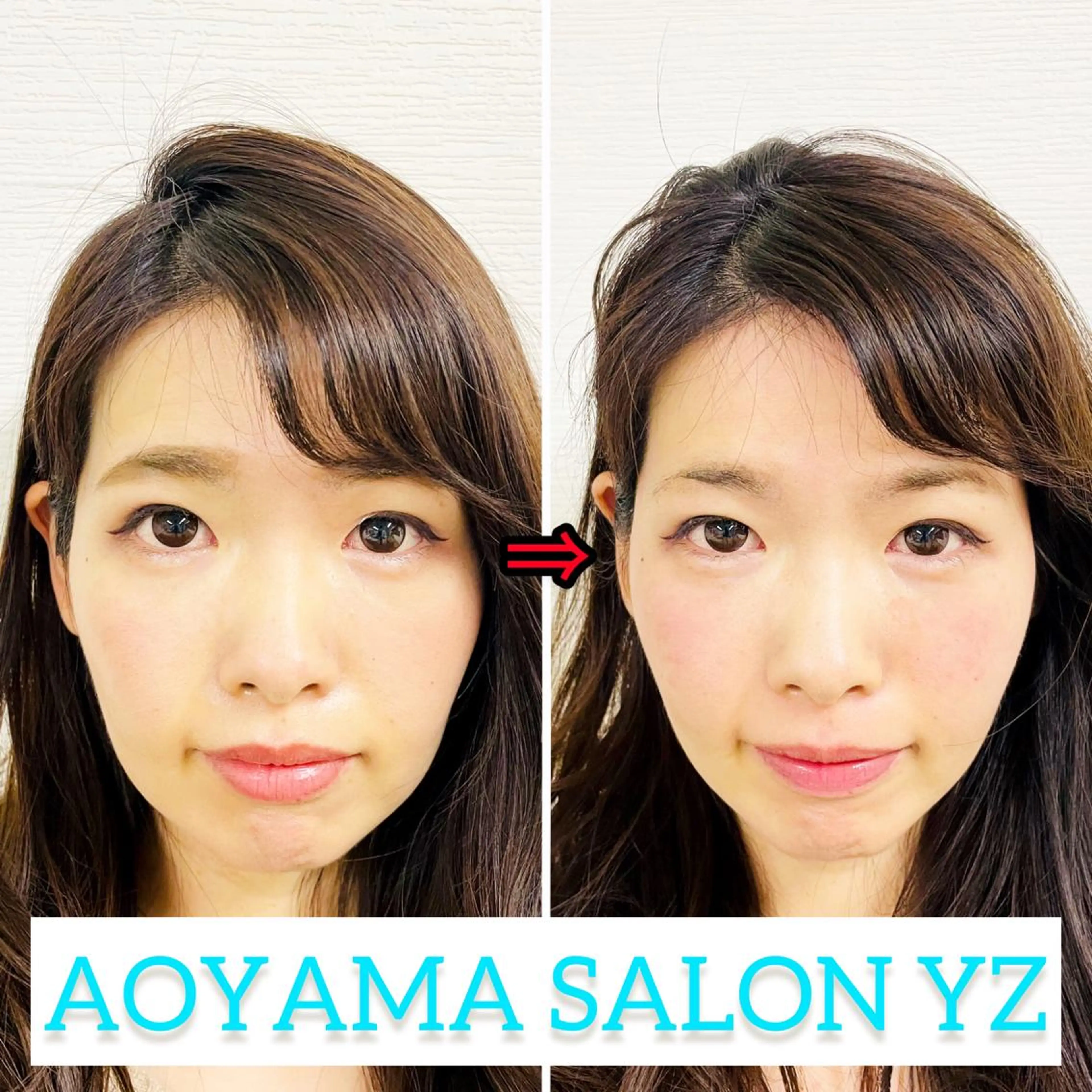 エステ リラク 小顔美容鍼専門サロン 渋谷YZのエステ・リラクイメージ