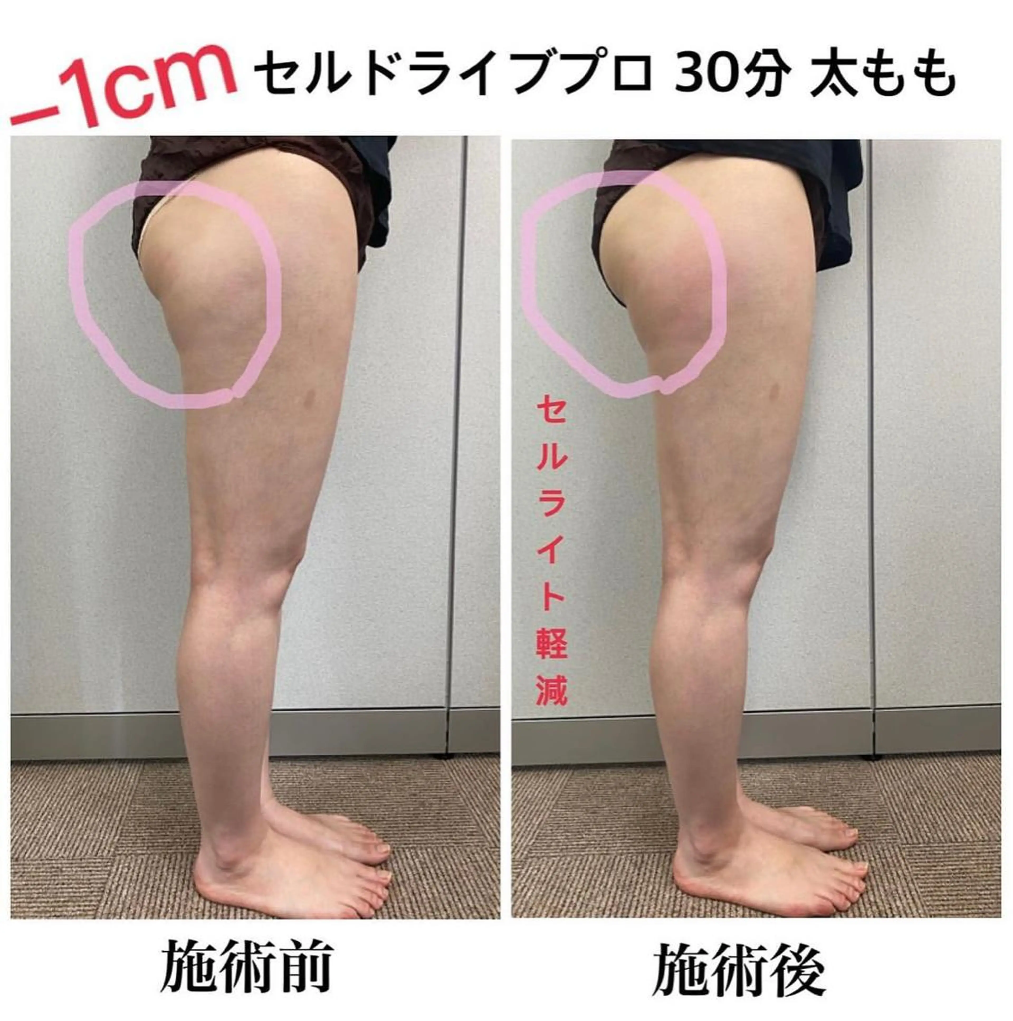 Venus所属・エステサロン Venusのエステ・リラクイメージ