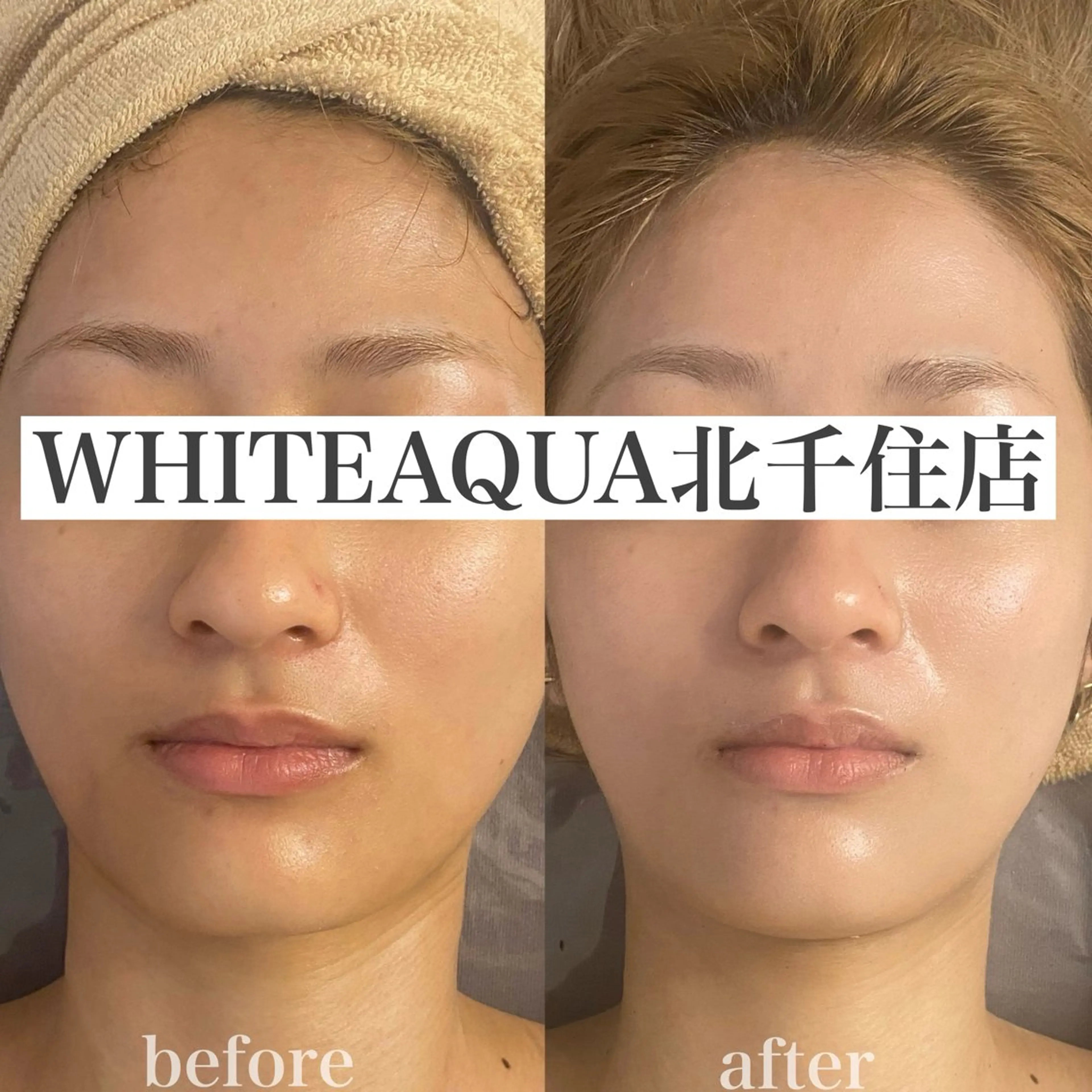 WHITE AQUA 北千住店のエステ・リラクイメージ