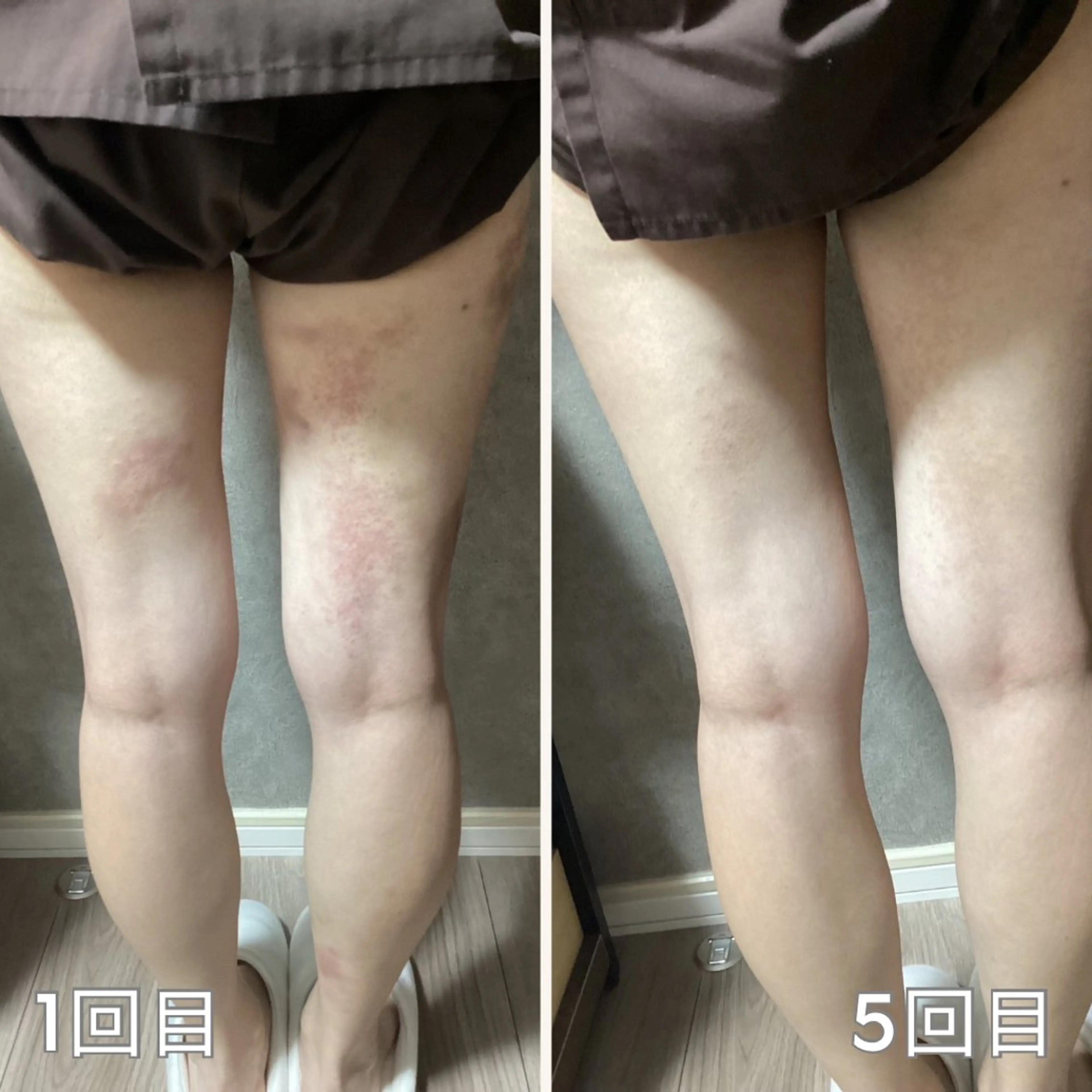 その他 リラクゼーション ～絃～のエステ・リラクイメージ