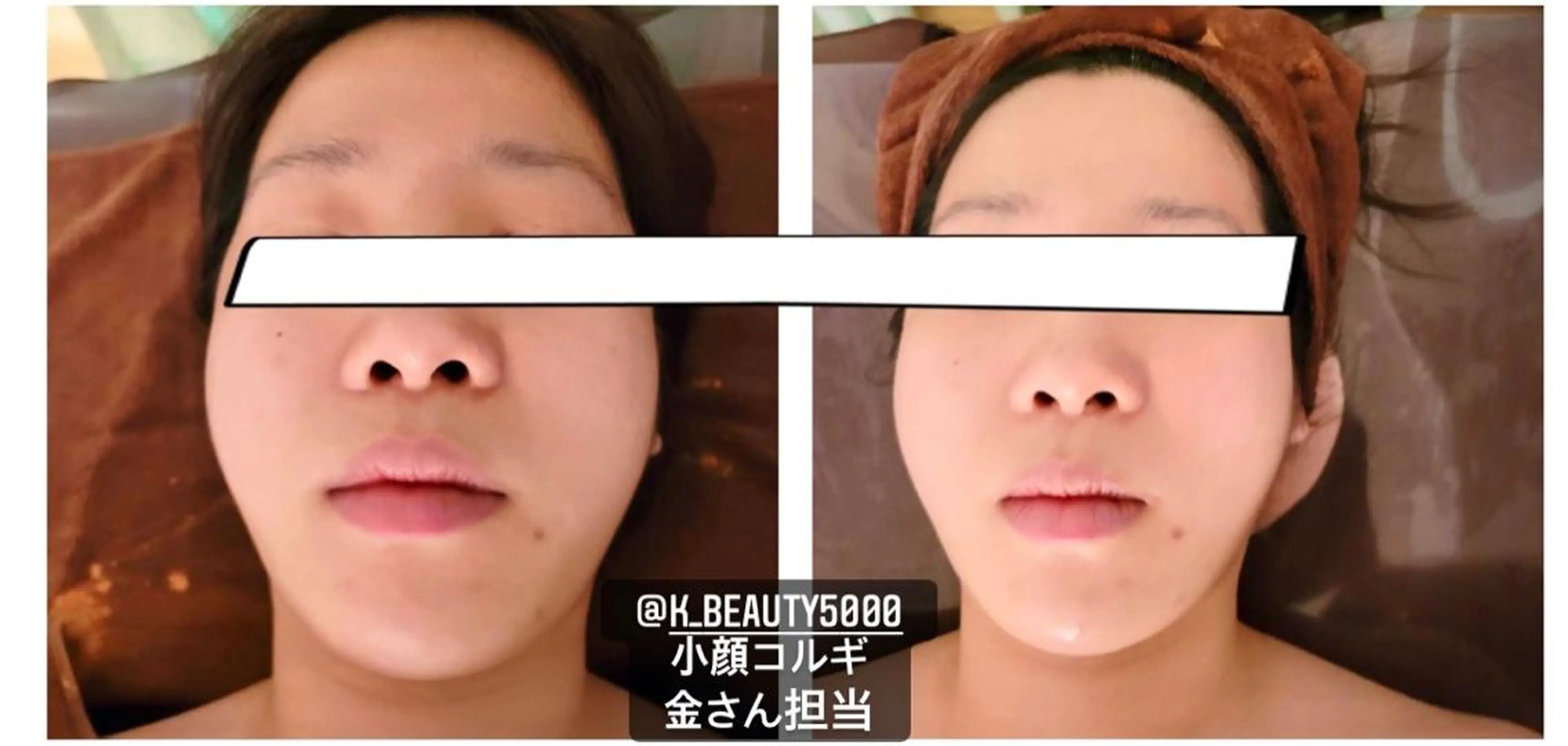 【ハイパーナイフ痩身&小顔コルギ&ハーブピーリング】K-Beauty　東新宿所属・kーbeauty痩身 フェイシャルのエステ・リラクイメージ