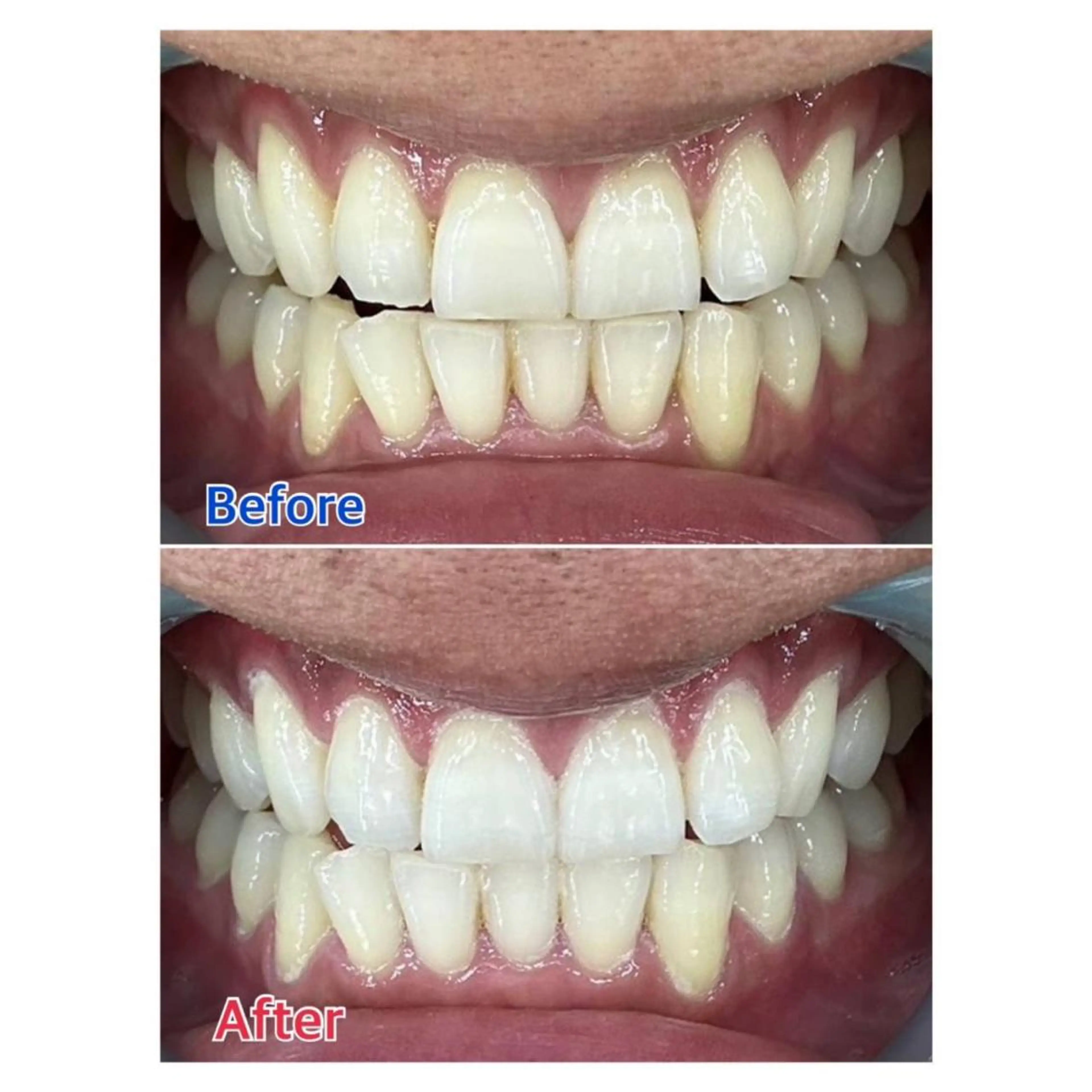 MBEAUTYSALON 千葉店・京成大久保所属・Melty 輝のその他イメージ