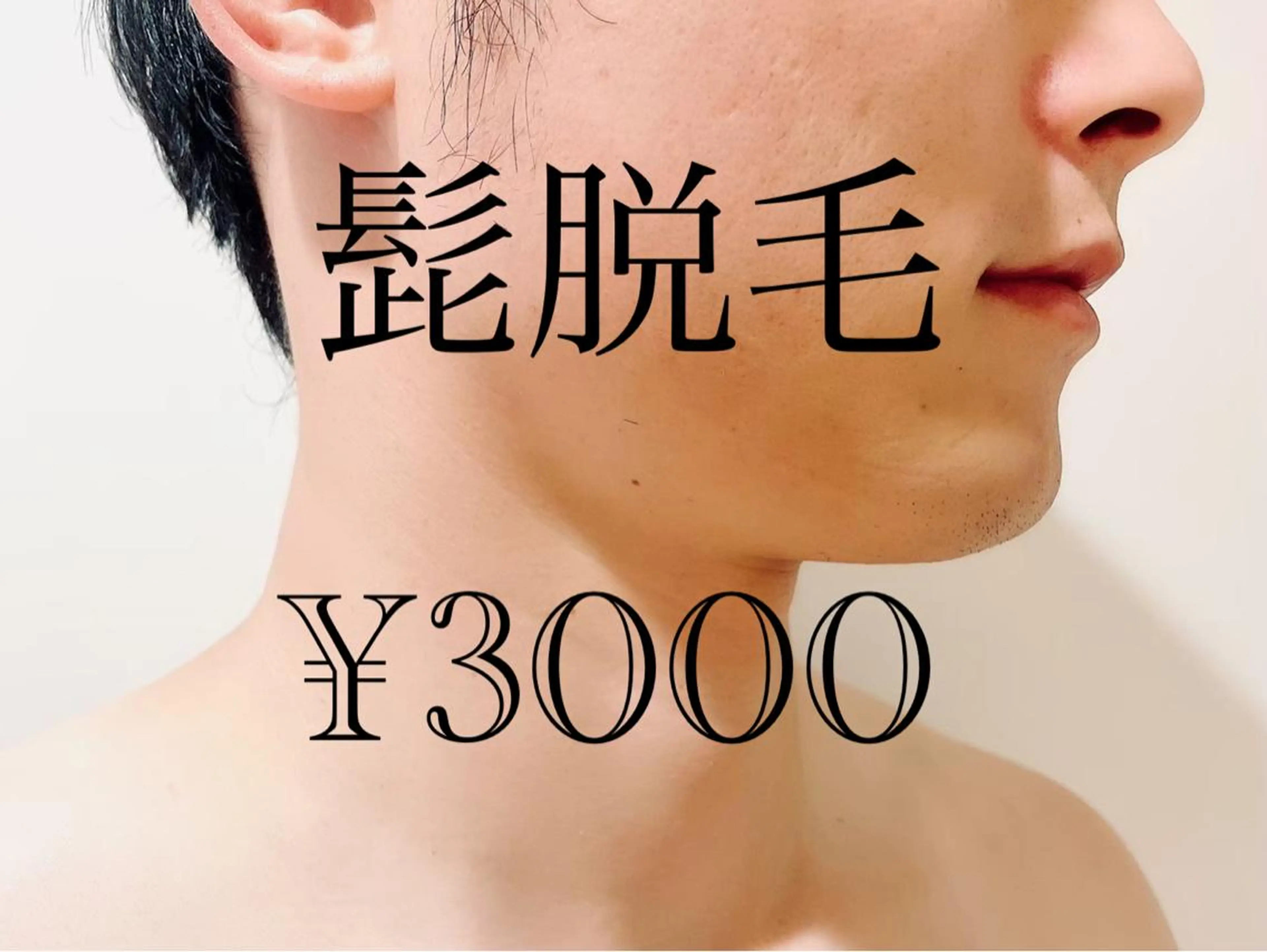 メンズ 脱毛 フェイシャル/脱毛 ジョアアンジェ　田中のエステ・リラクイメージ