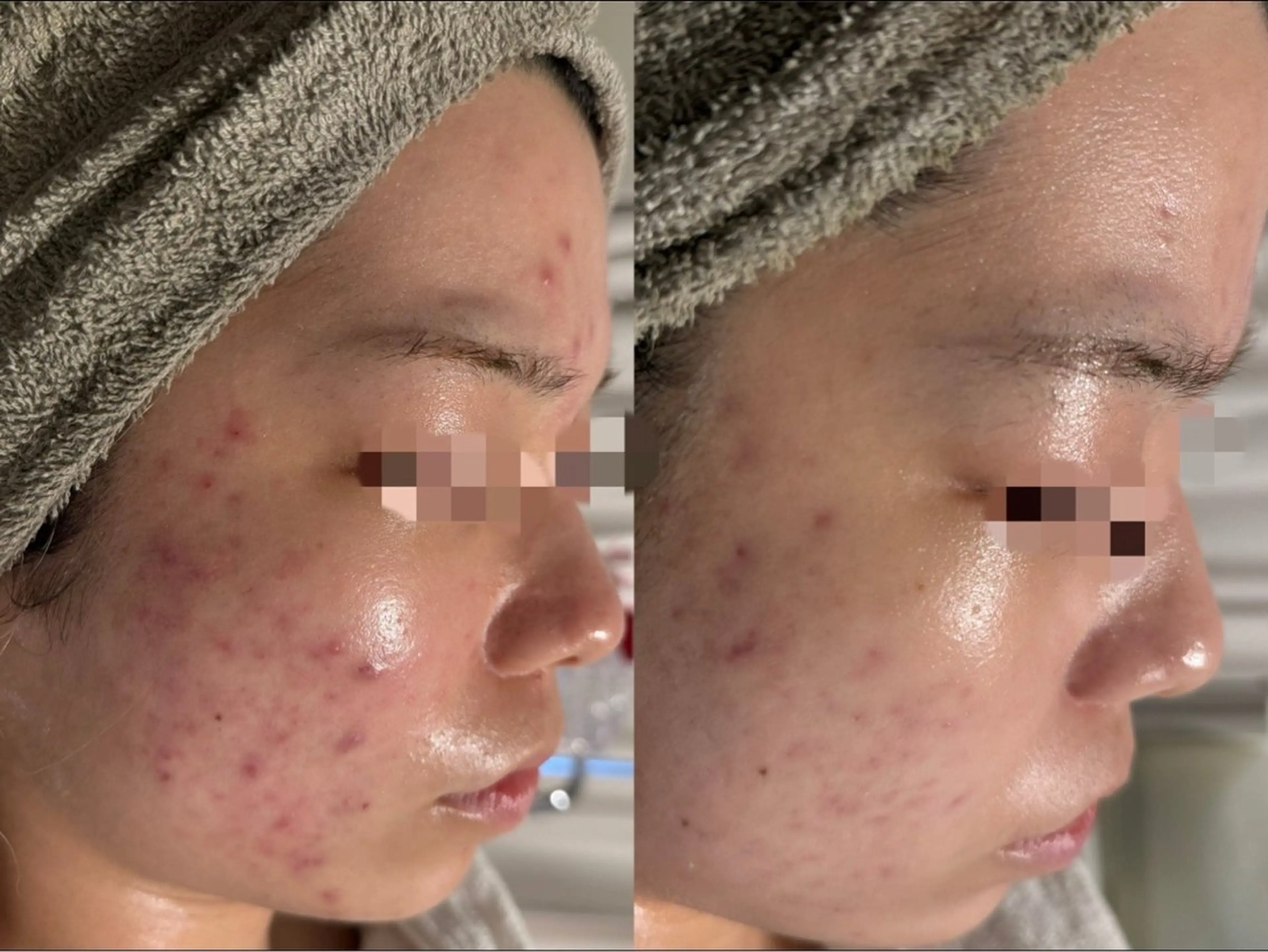 lumirise所属・lumi riseのエステ・リラクイメージ