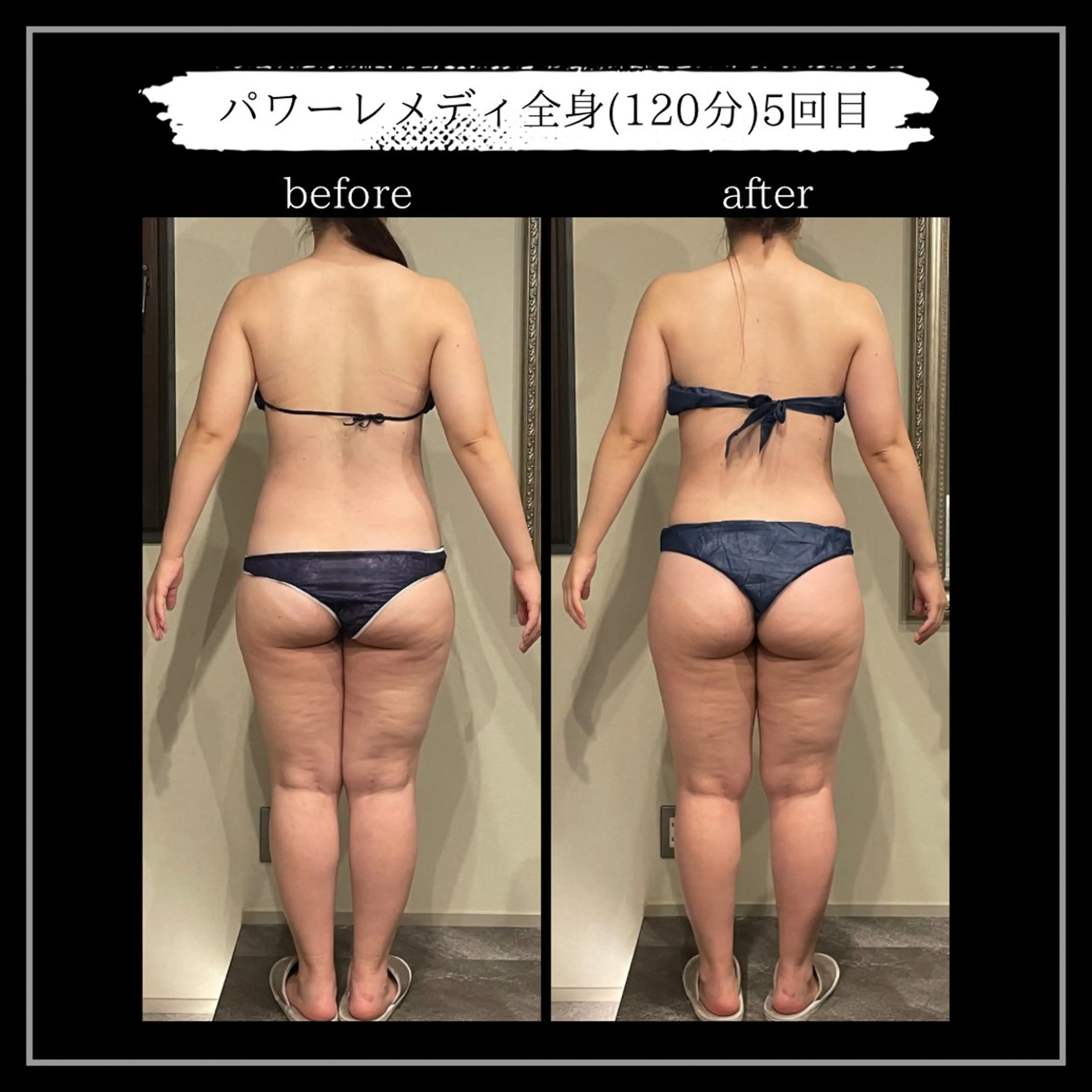 オフ:オン所属・オフ:オン 全身筋膜マッサージのエステ・リラクイメージ