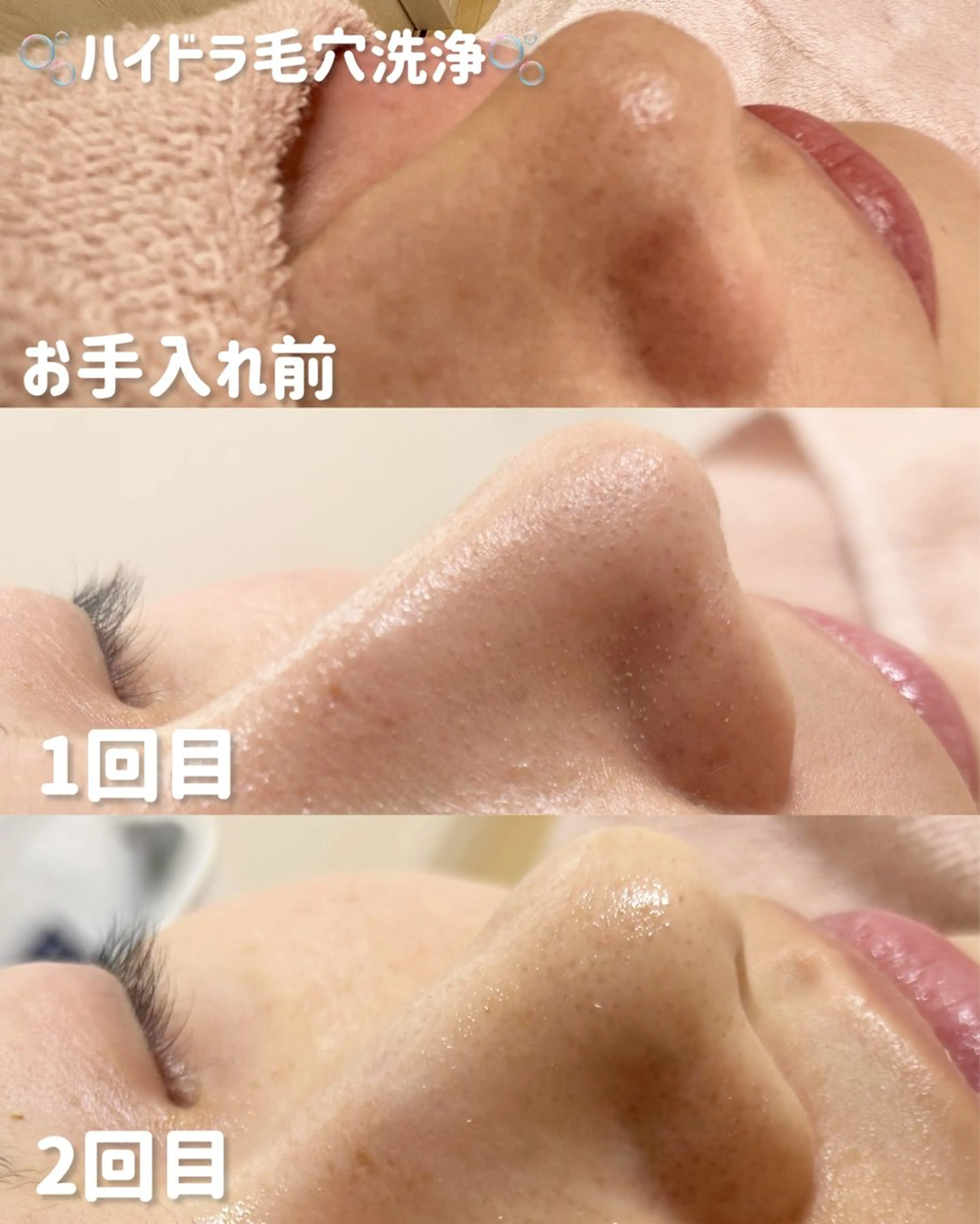 その他 lulularico Yu🫧のエステ・リラクイメージ