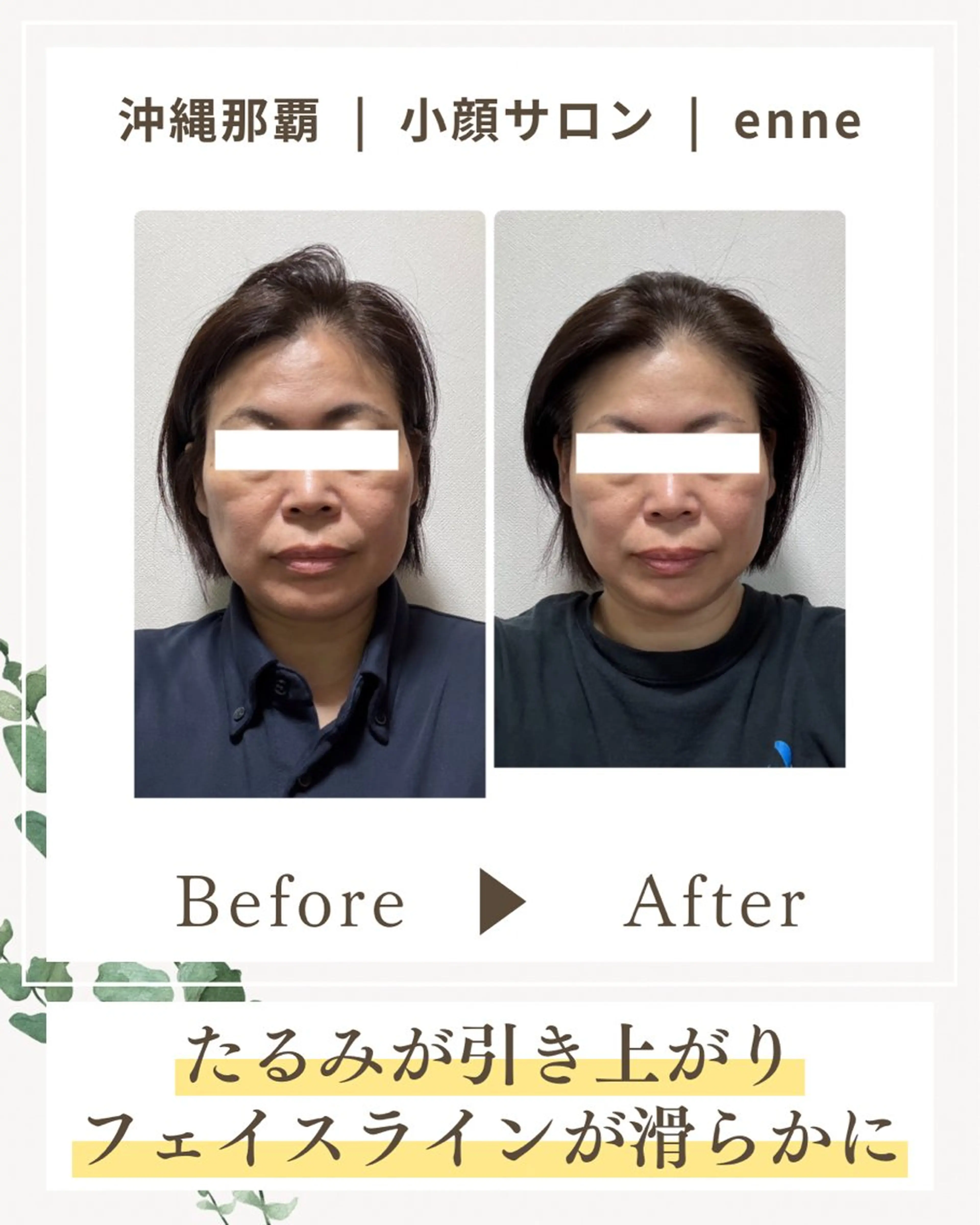 その他 小顔サロンenne所属・小顔サロンenne 【エンネ】のその他イメージ