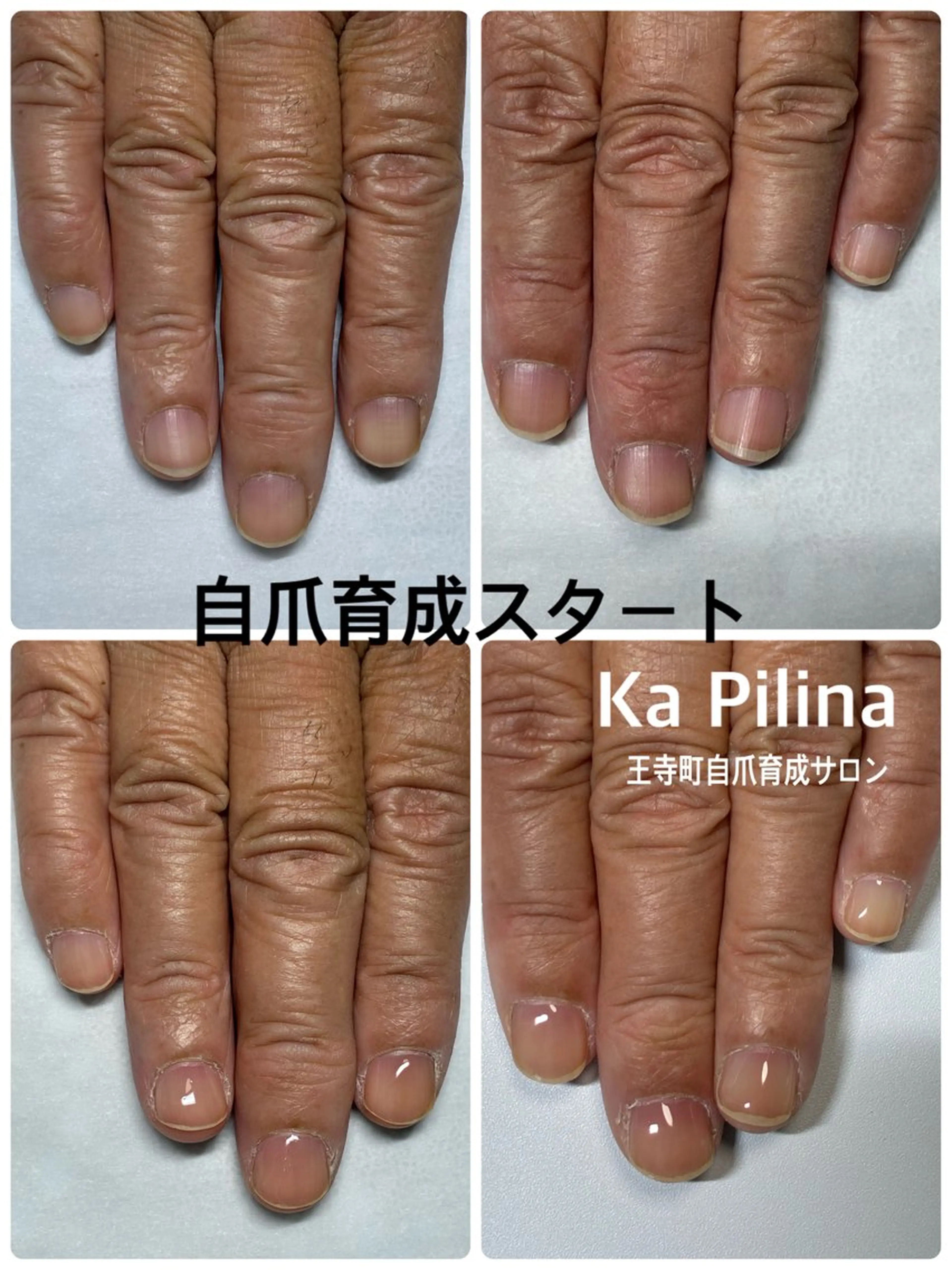 モニター限定自爪育成クリアの写真