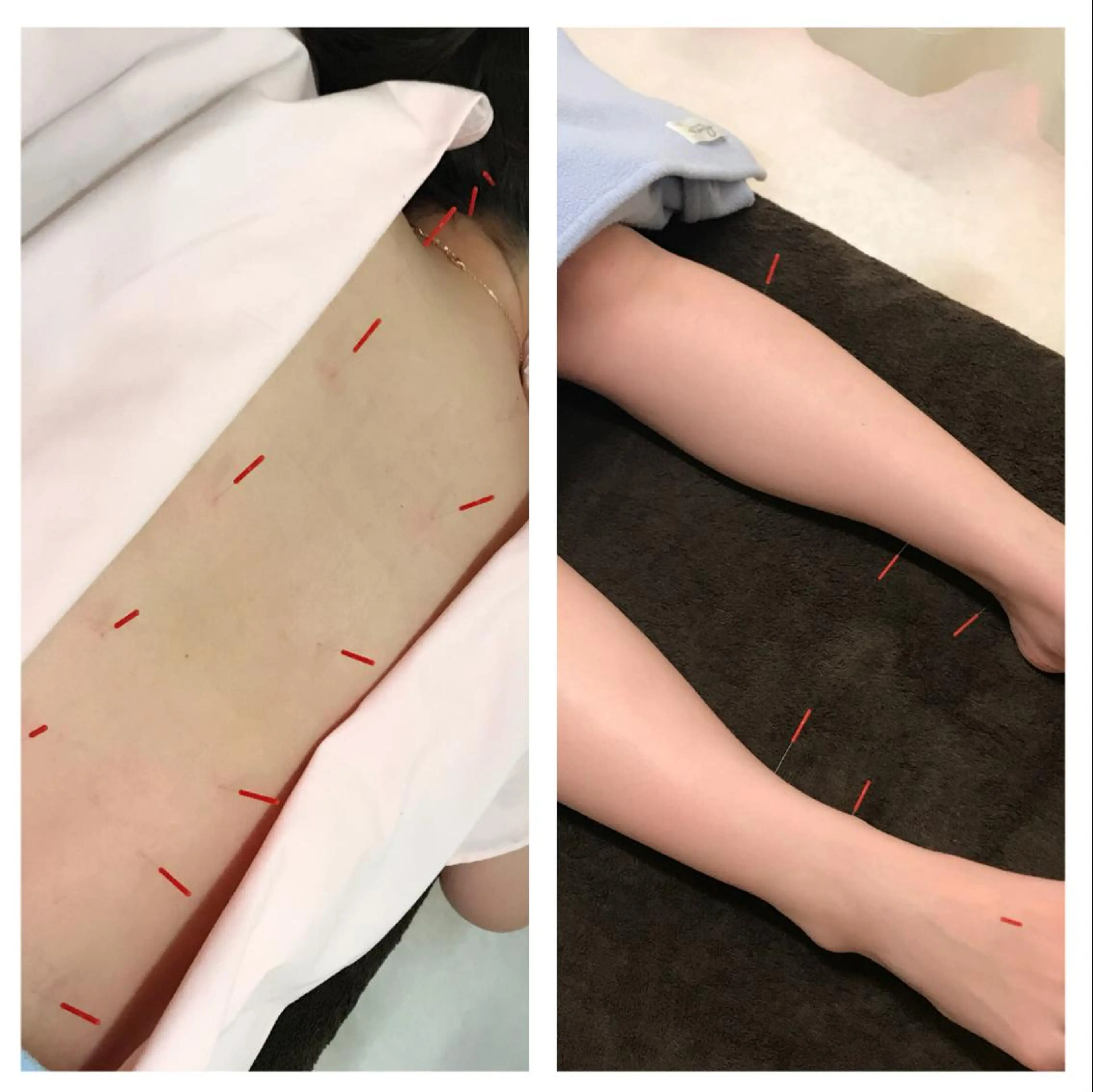 その他 やまだ鍼灸接骨院（やまだしんきゅうせっこついん）所属・山田 晃のエステ・リラクイメージ