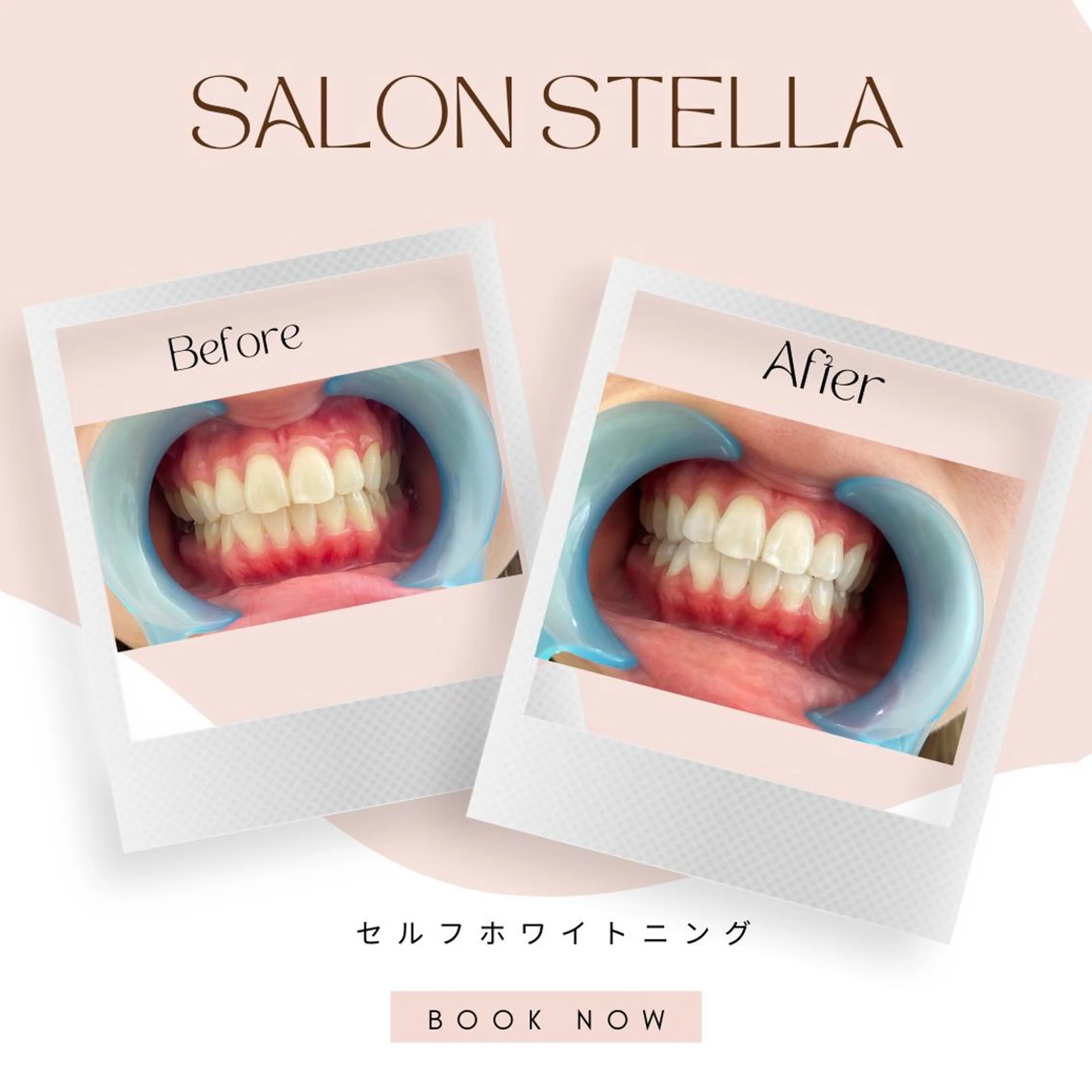 その他 毛穴・ハーブ・シミ STELLAのエステ・リラクイメージ